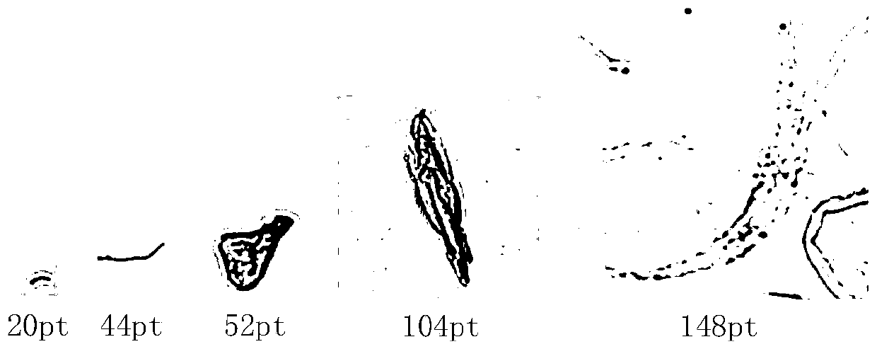 Urinary sediment image recognition system and method based on deep learning