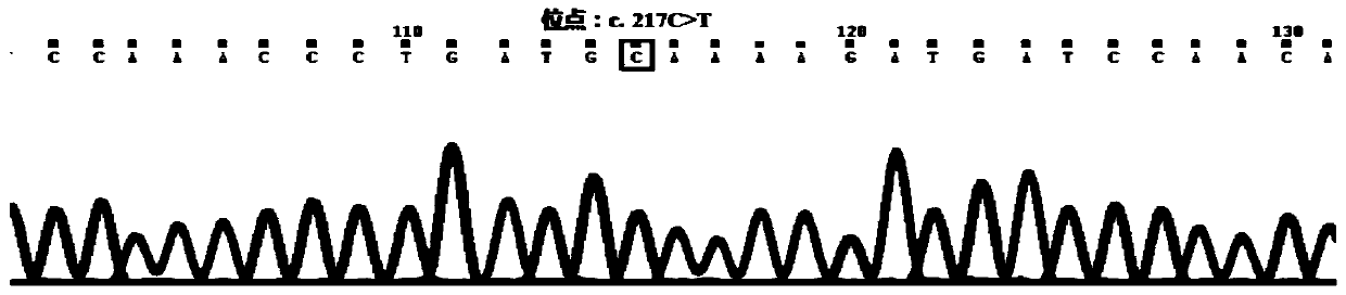 Primer set for detecting vitamin B12 metabolism gene mutation and application method thereof