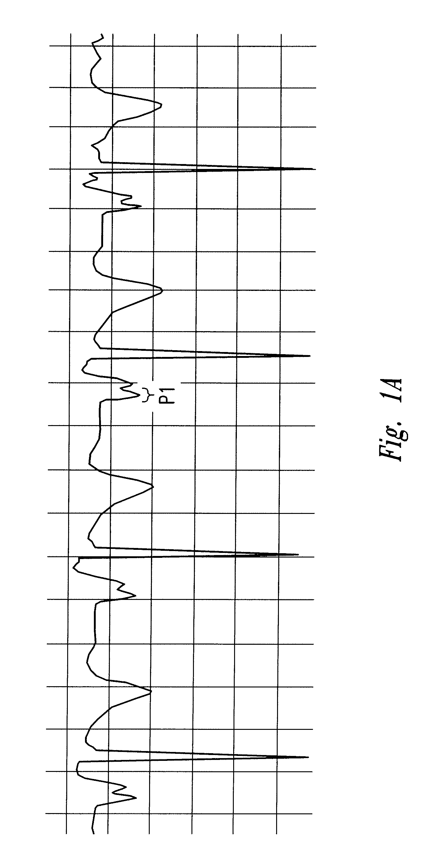 Method of locating the tip of a central venous catheter