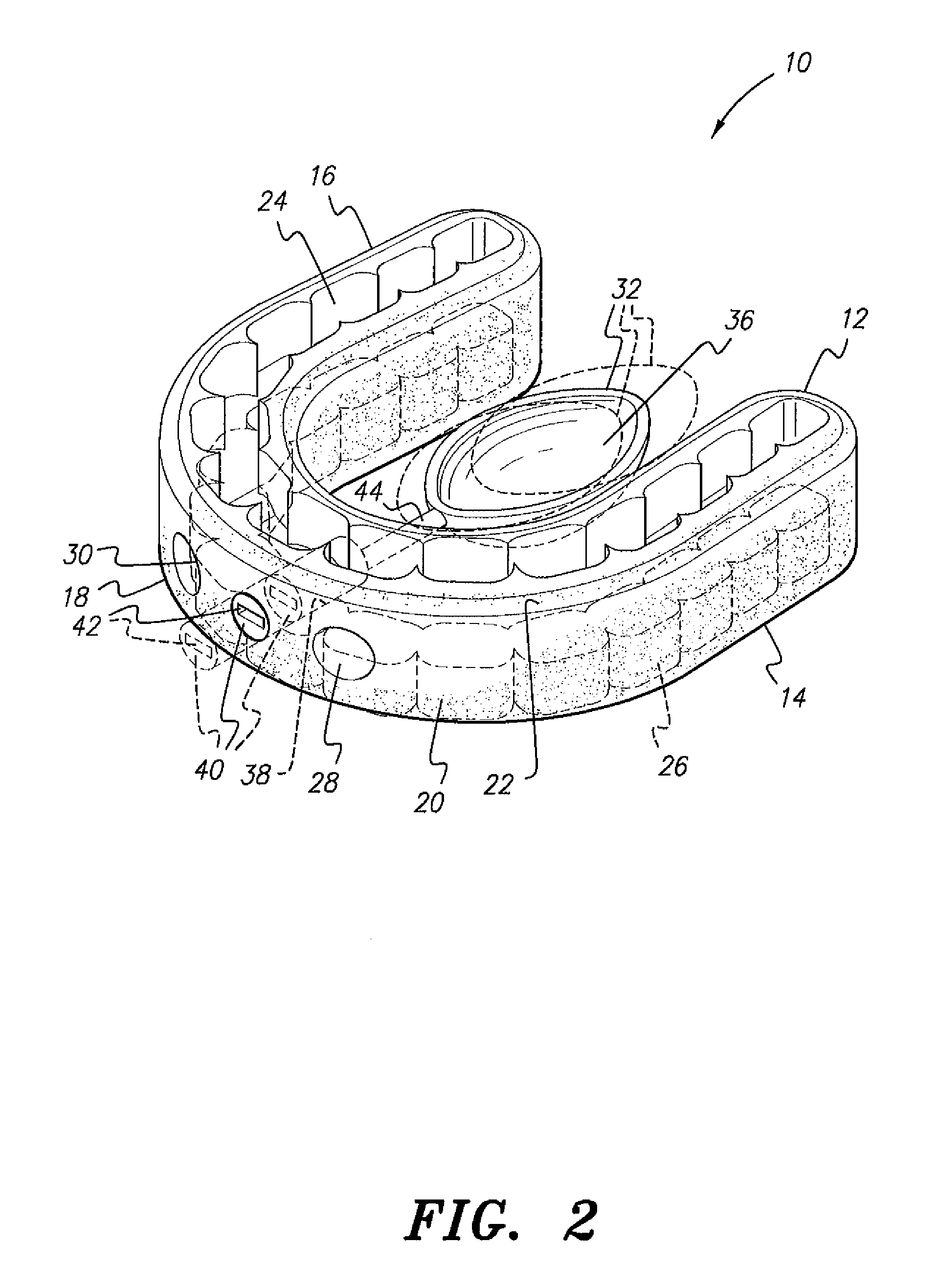 Oral appliance for the treatment of sleep apnea