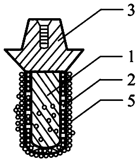 Personalized biomimetic dental implant and manufacturing method thereof