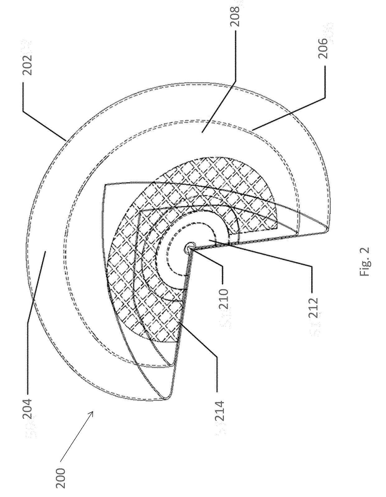 Composite implant material