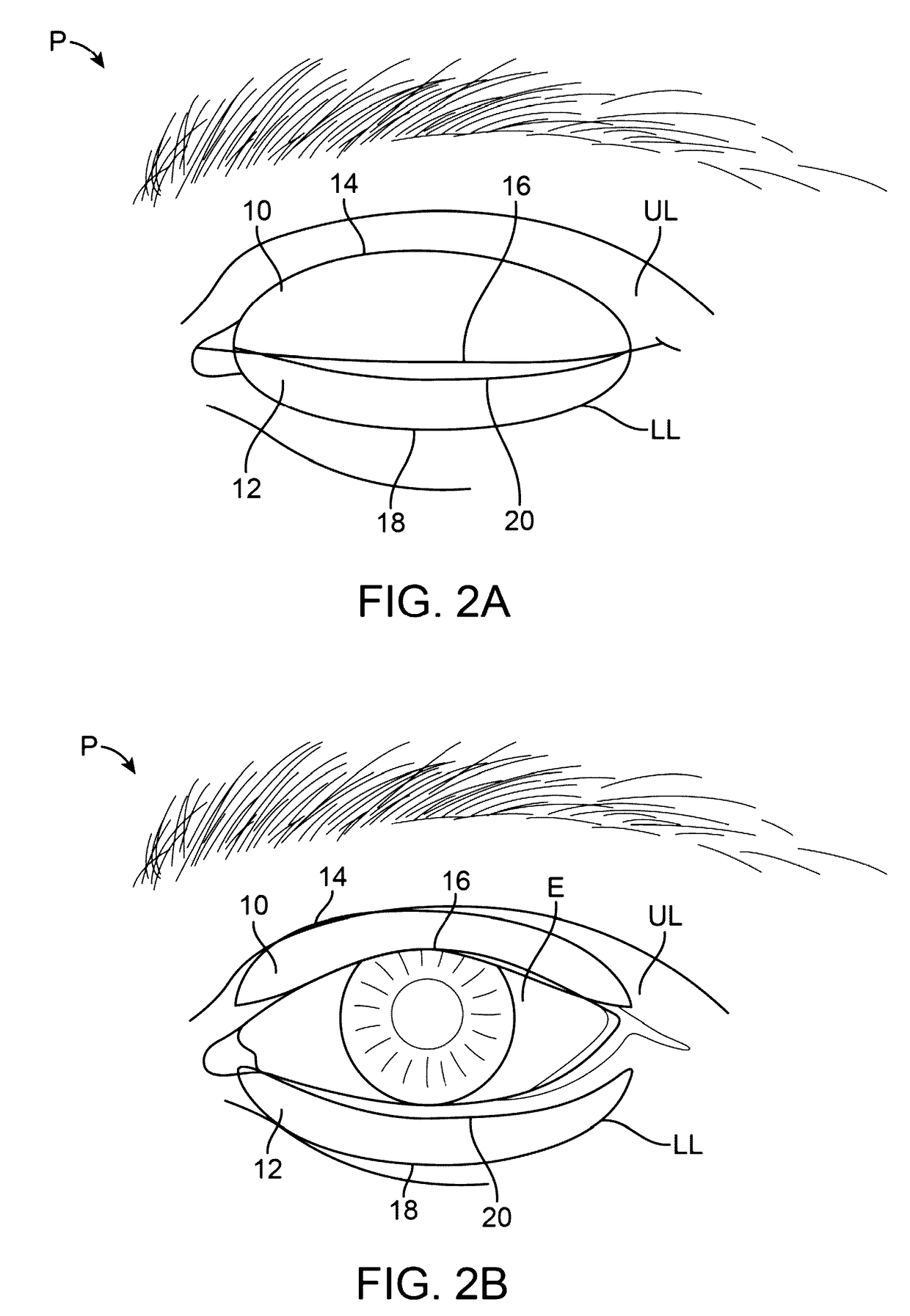 Combination treatment systems