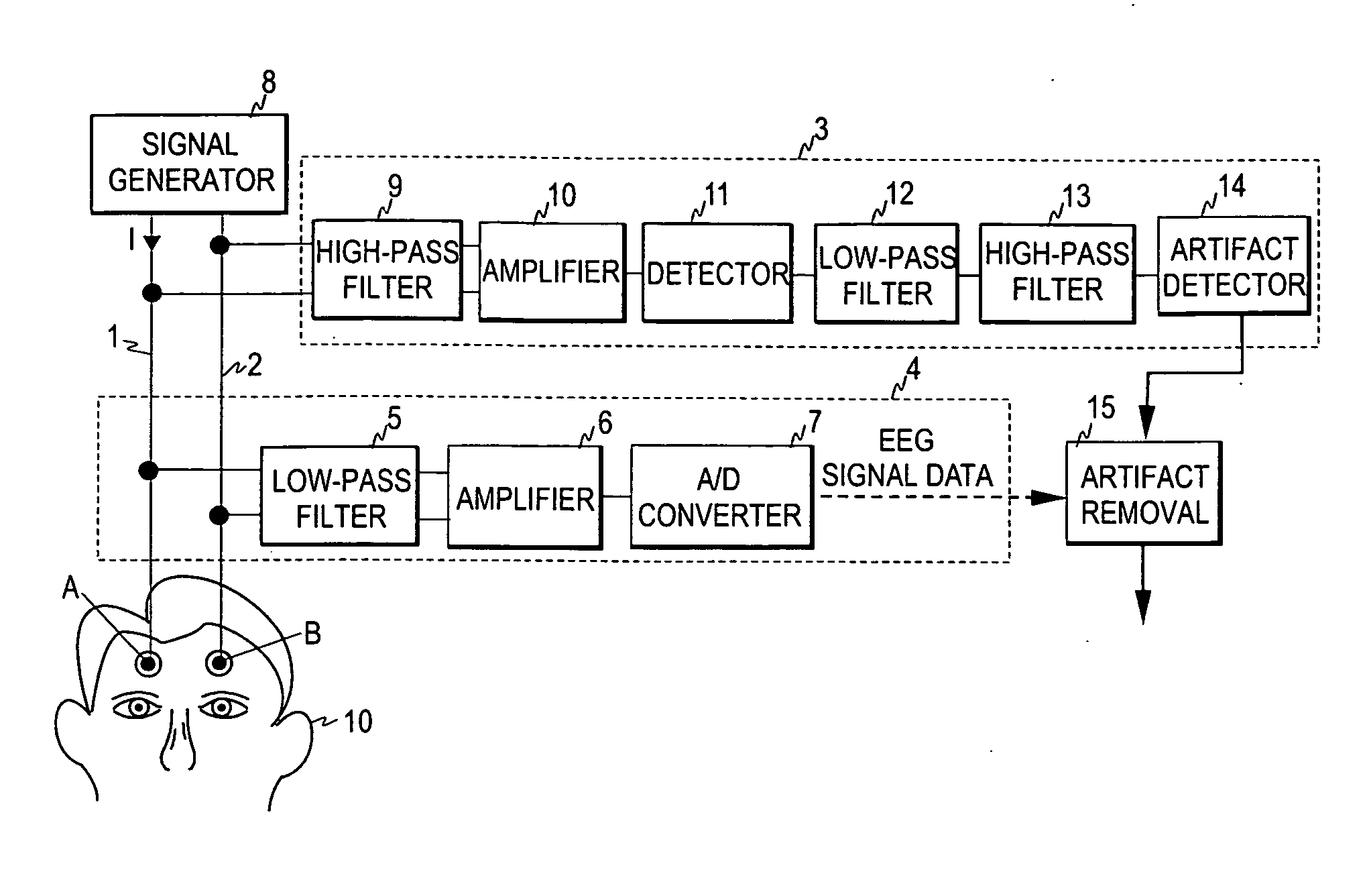 Detection of artifacts in bioelectric signals