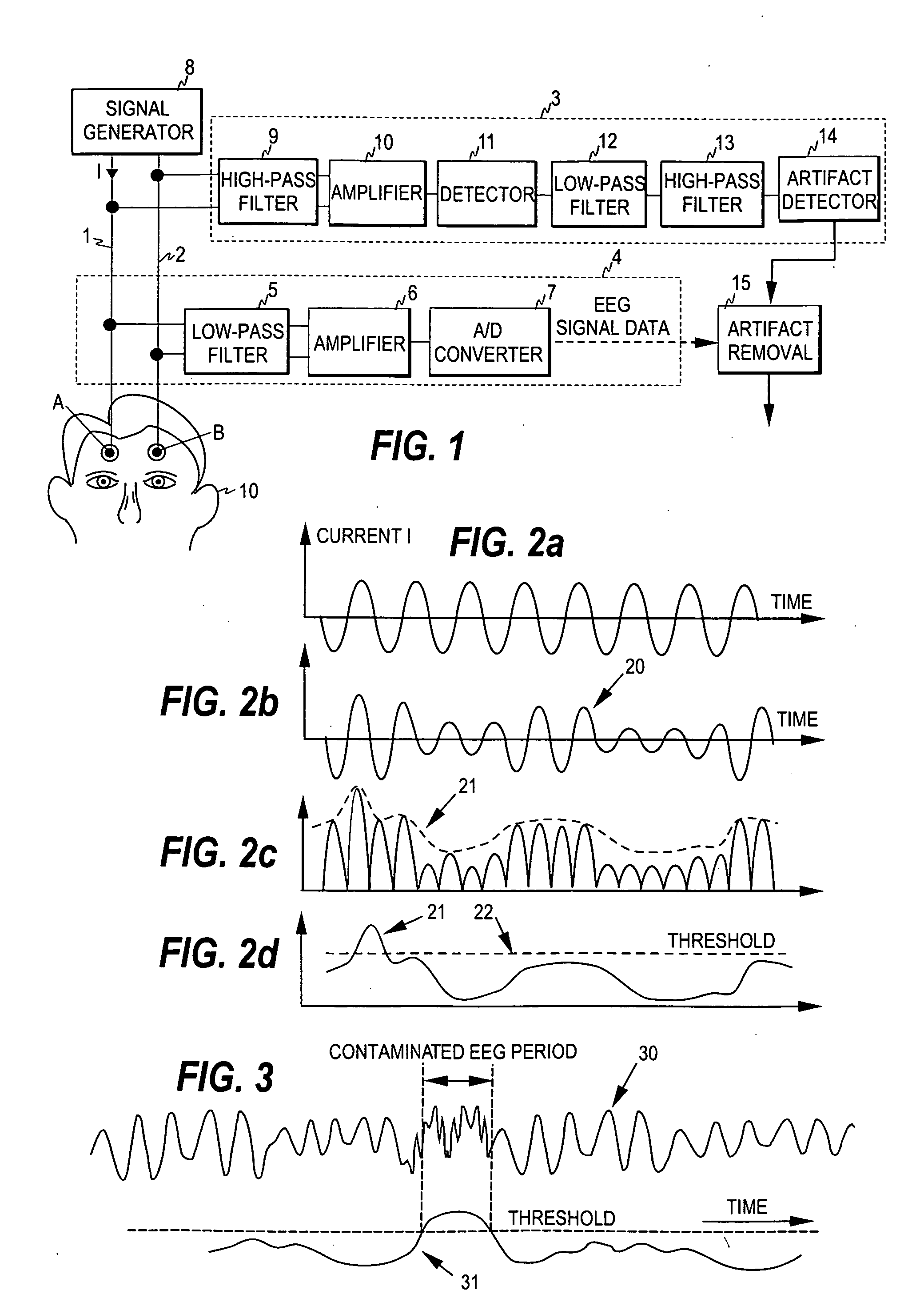 Detection of artifacts in bioelectric signals