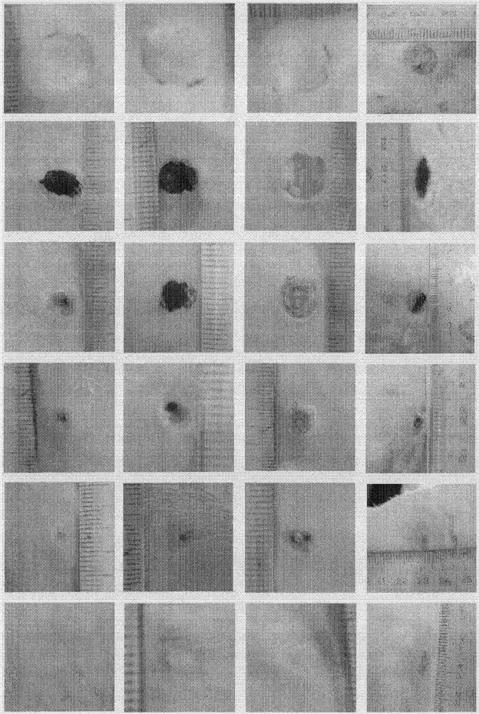 Dressing composition used for inhibiting scars and accelerating wound healing and application thereof