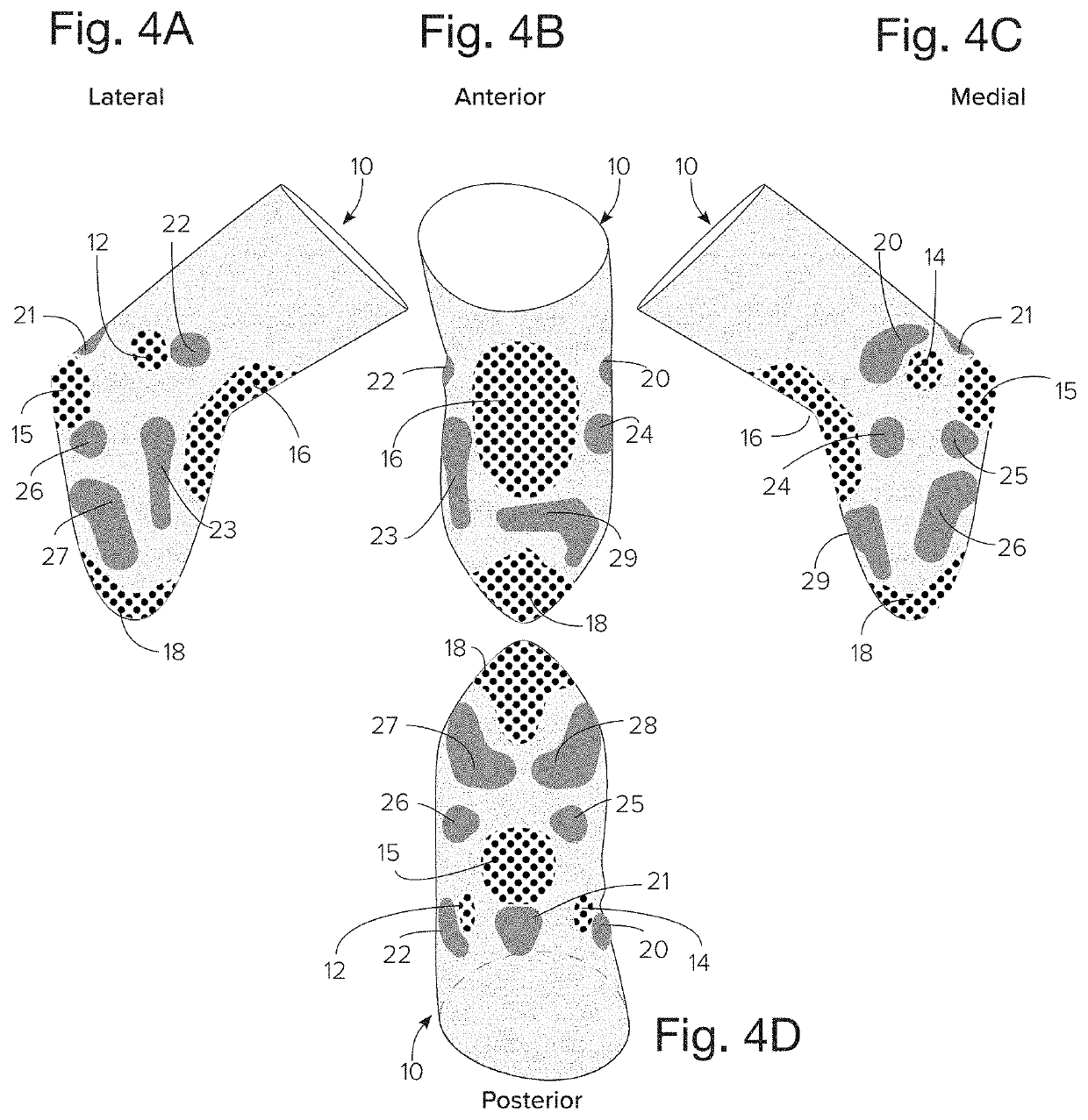 Variable compliance prosthetic socket with breathable matrix