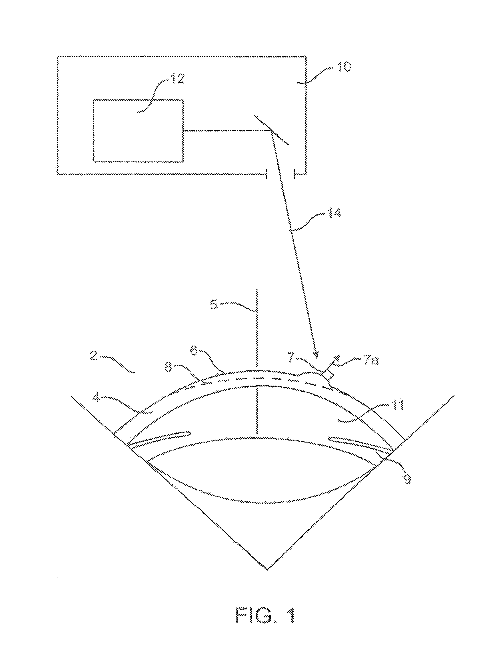 System and method for ophthalmic surface based on objective quality estimation