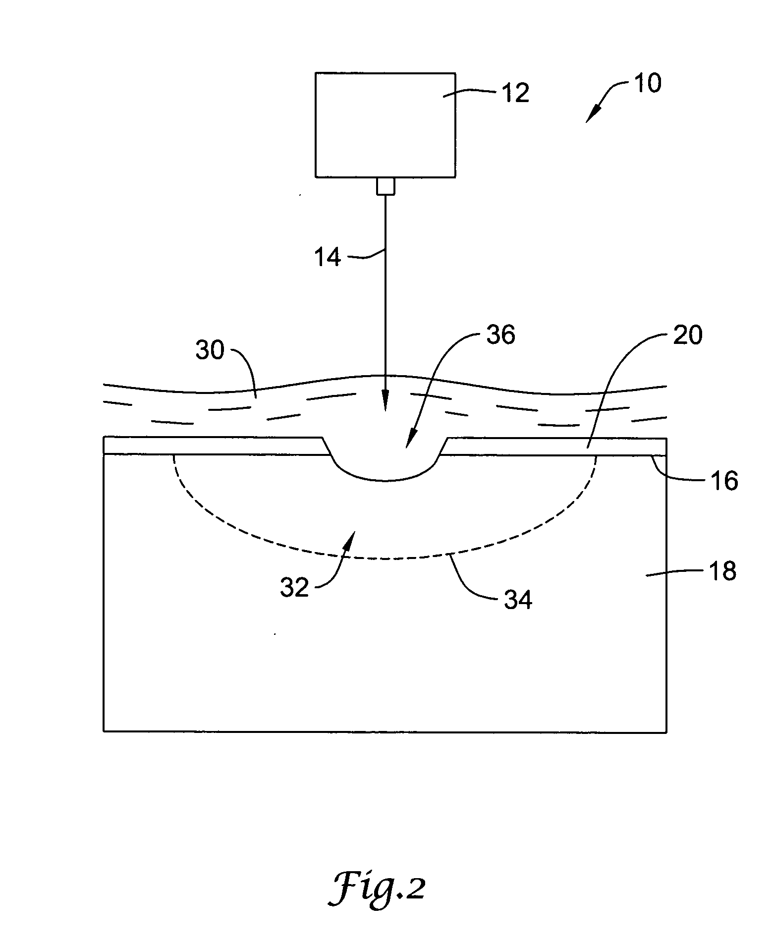 Laser shock peening of medical devices