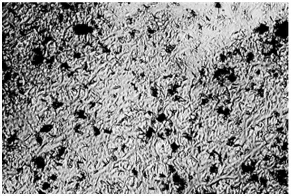 High-concentration loading gel of adriamycin medicine and preparation method of high-concentration loading gel