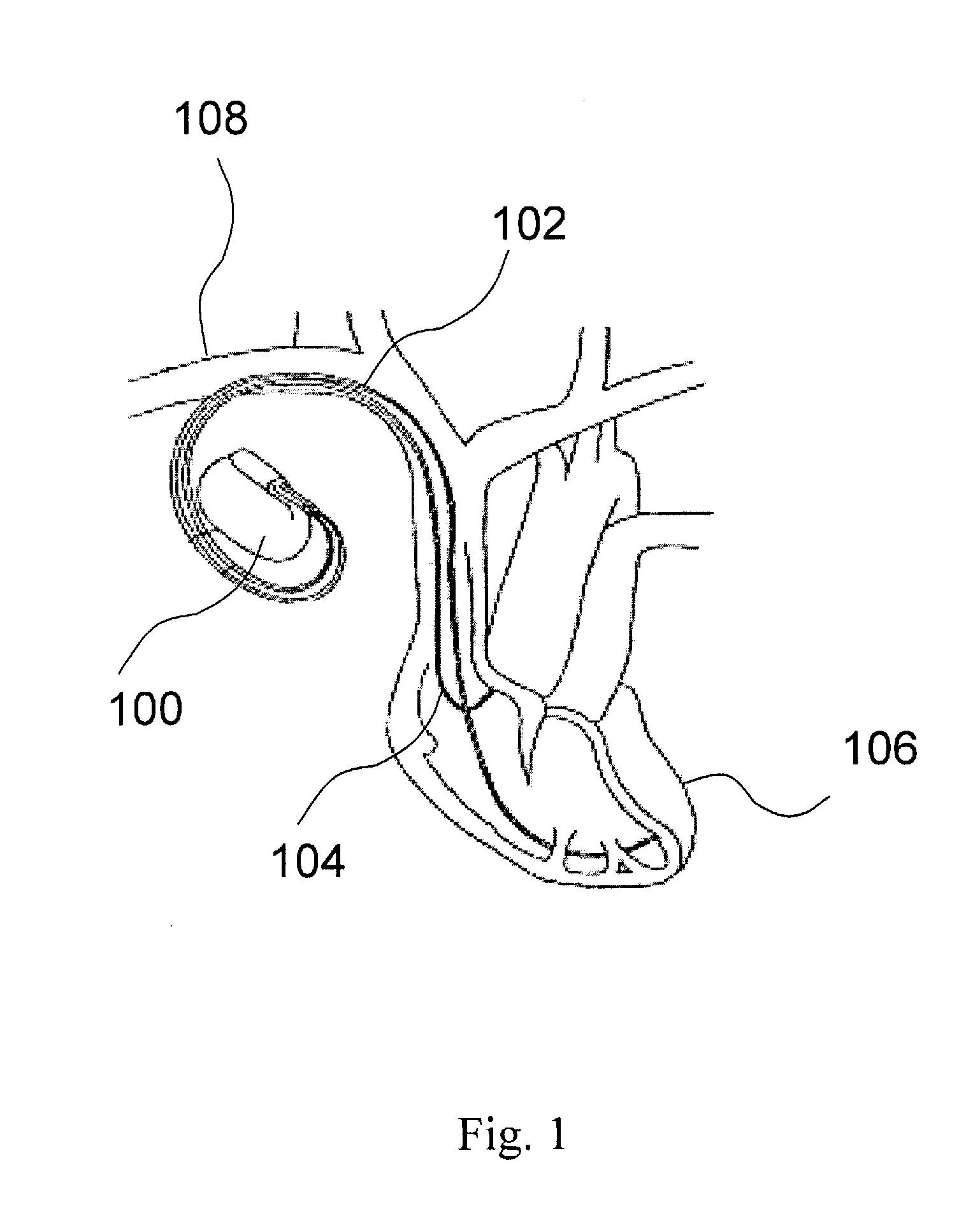 Method and device for collecting rem sleep data