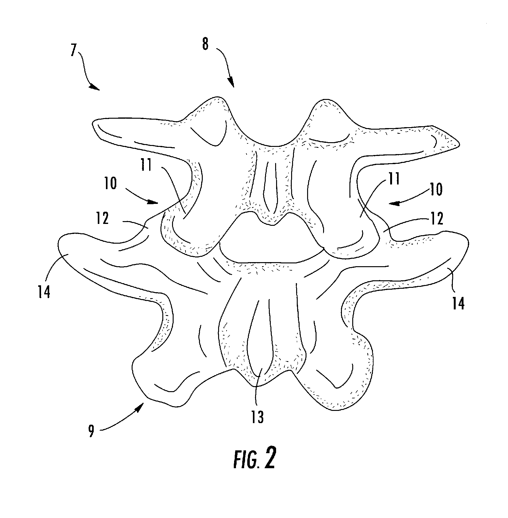 Connecting rod for bone anchors having a bioresorbable tip