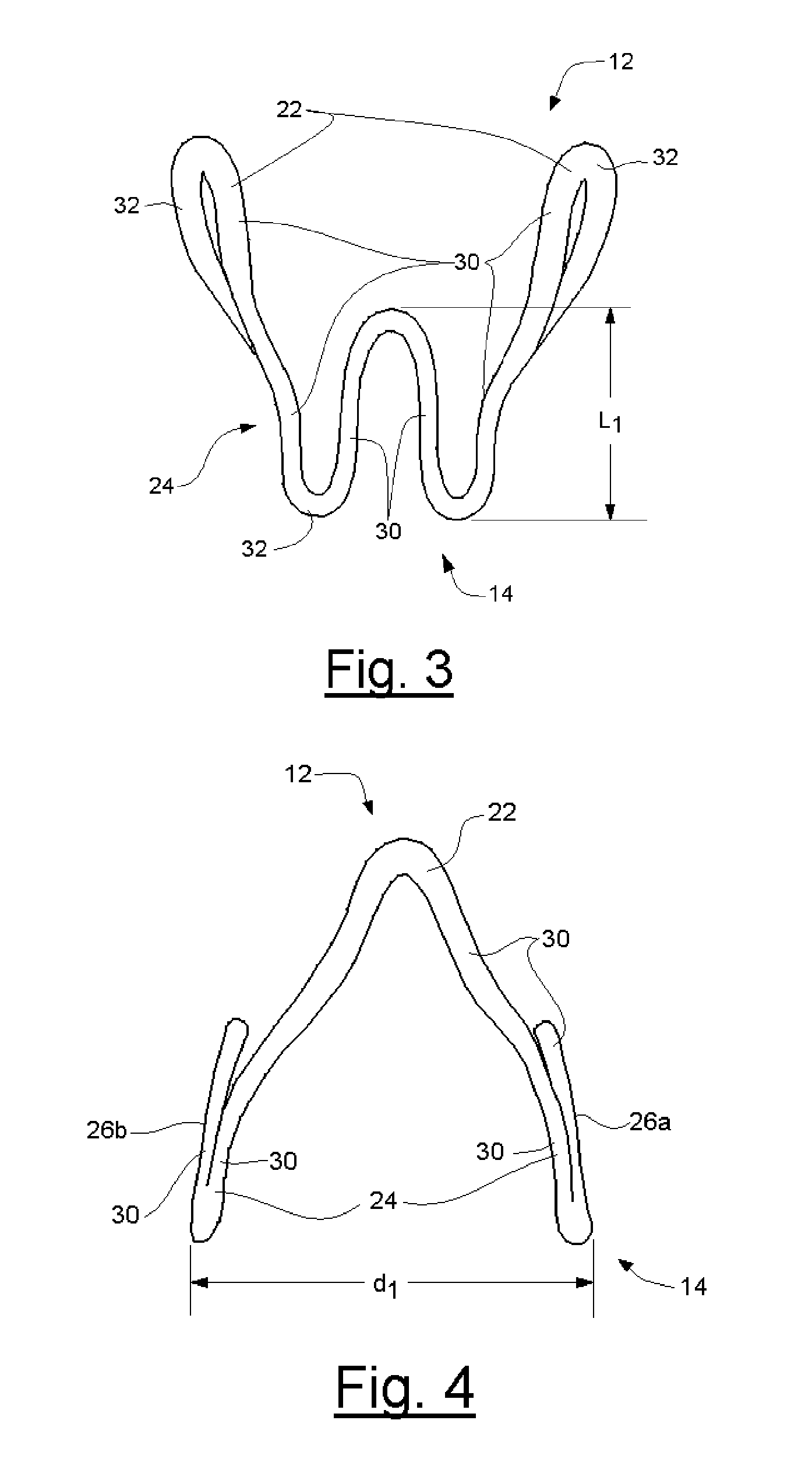 Intravaginal incontinence device