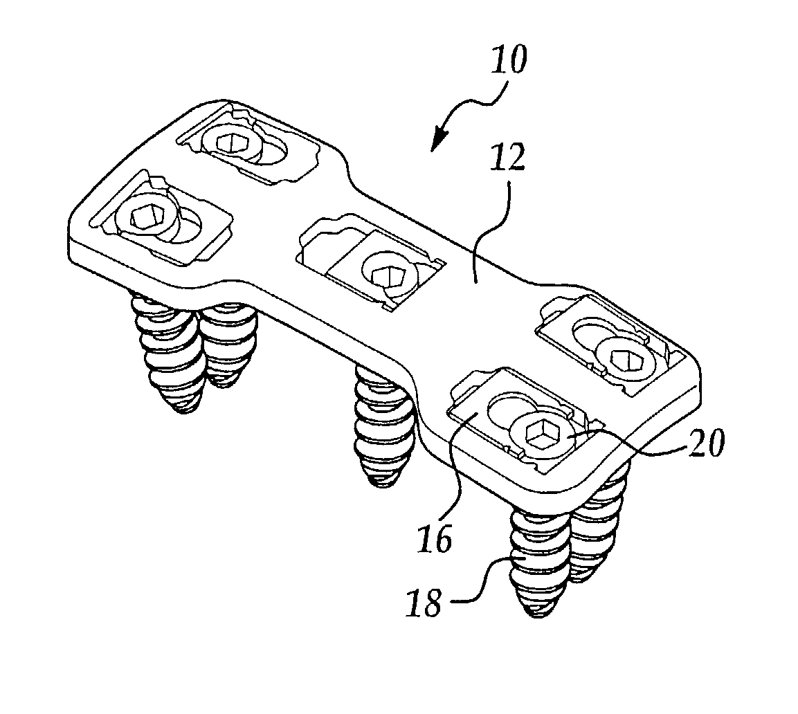 Bone plate and screw retaining mechanism