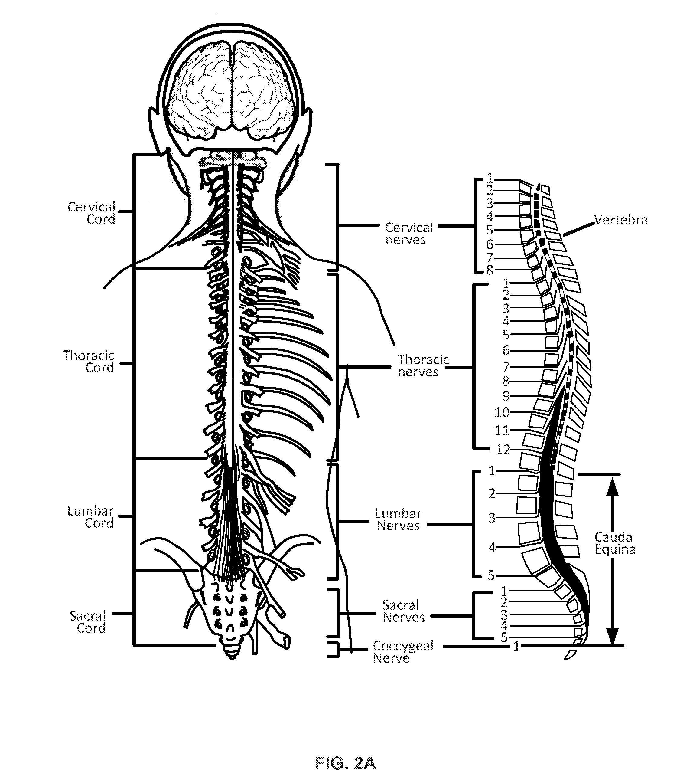 Implantable nerve stimulator having internal electronics without asic and methods of use