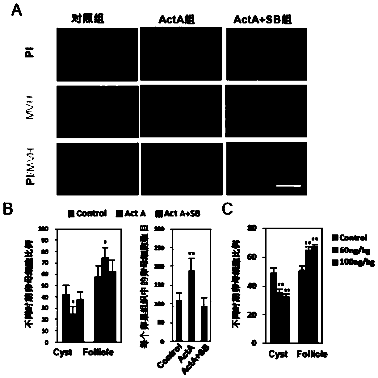 Method for promoting primordial follicle library formation by activin A