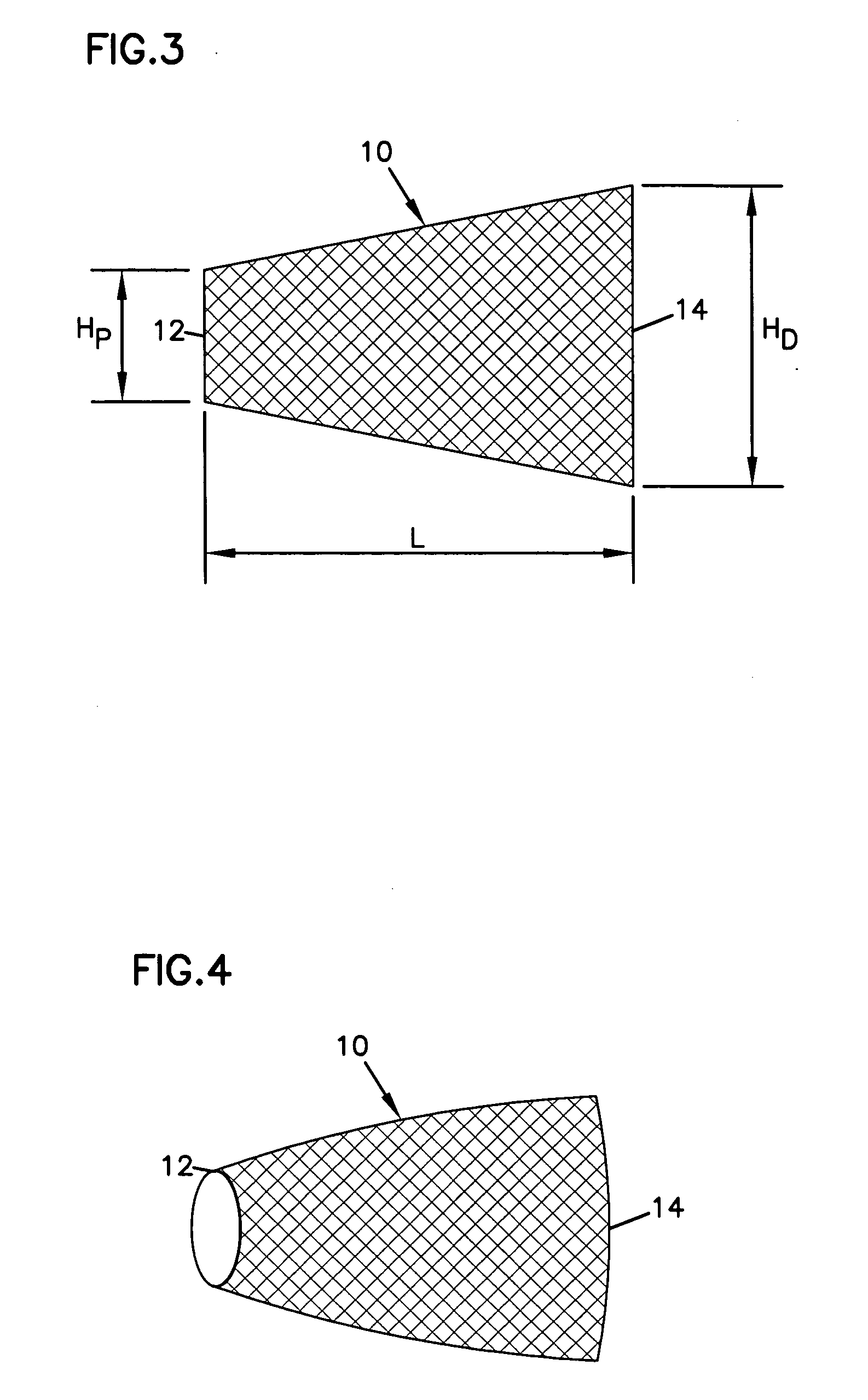 Tongue implant for sleep apnea