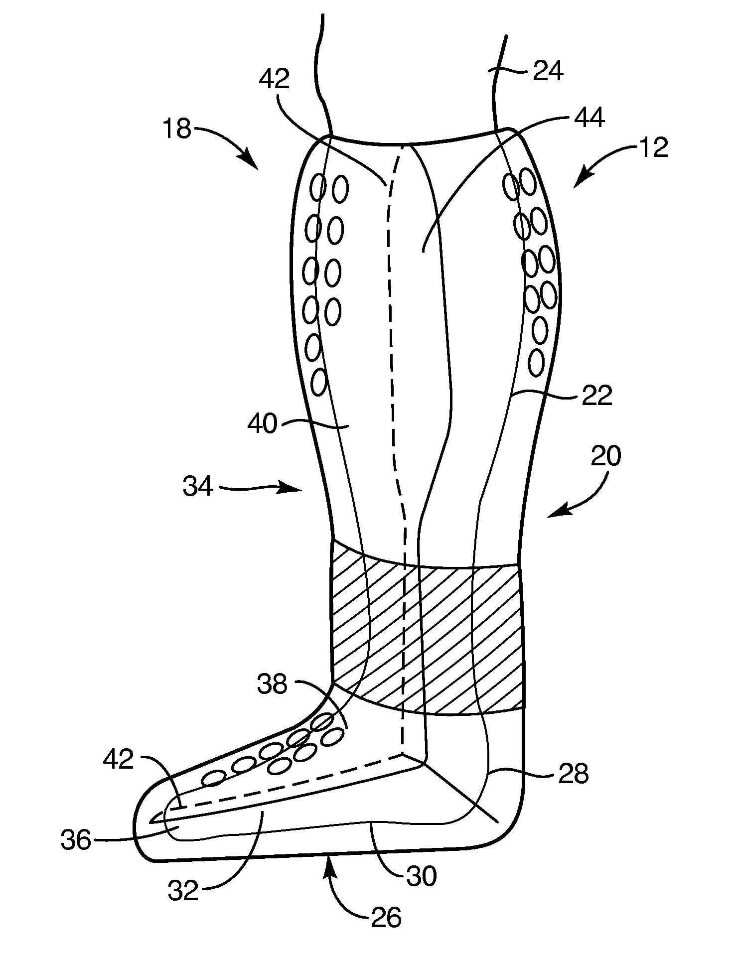 Systems and methods for providing a total contact and offloading cast