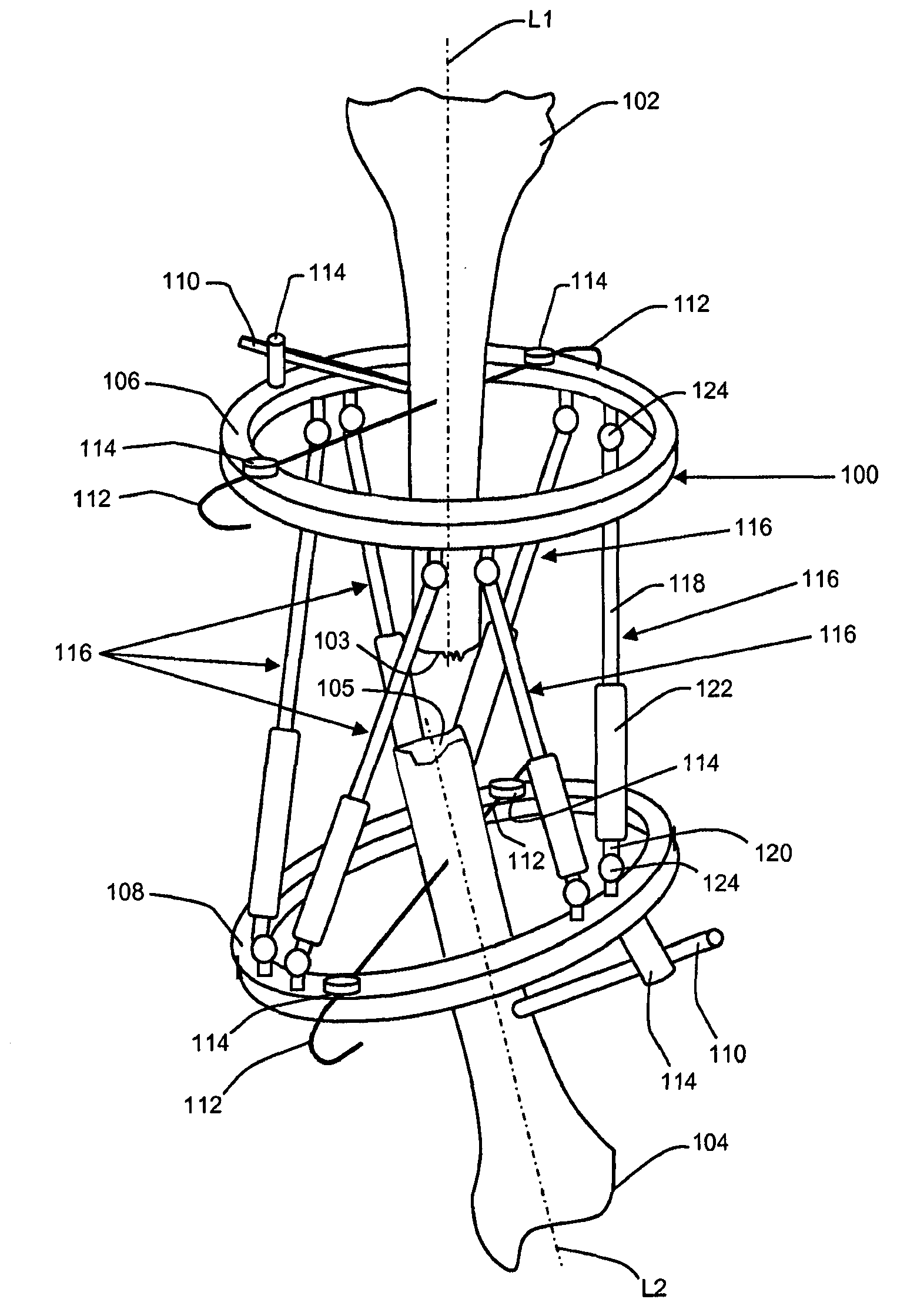 Orthopedic fixation with imagery analysis