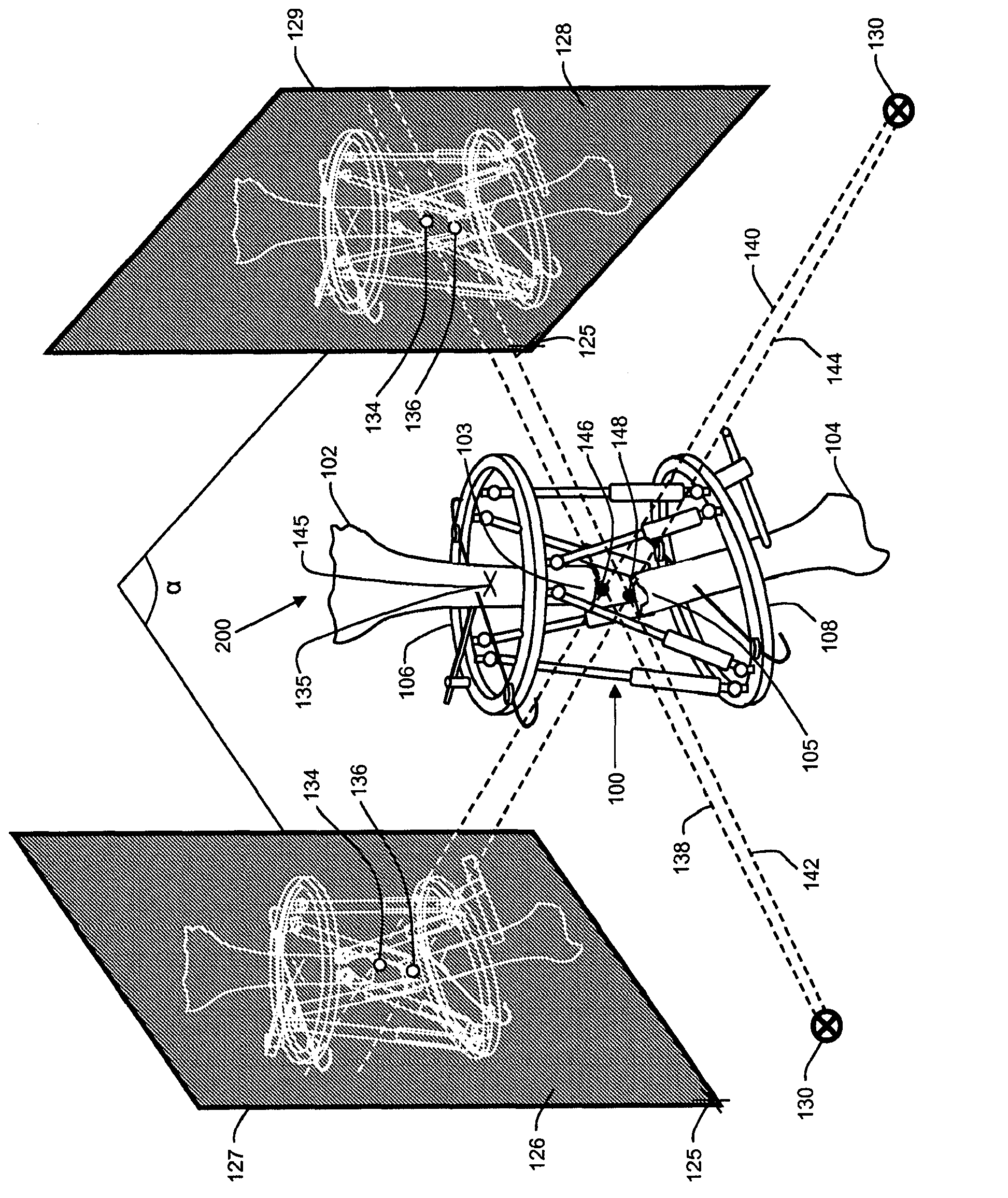 Orthopedic fixation with imagery analysis