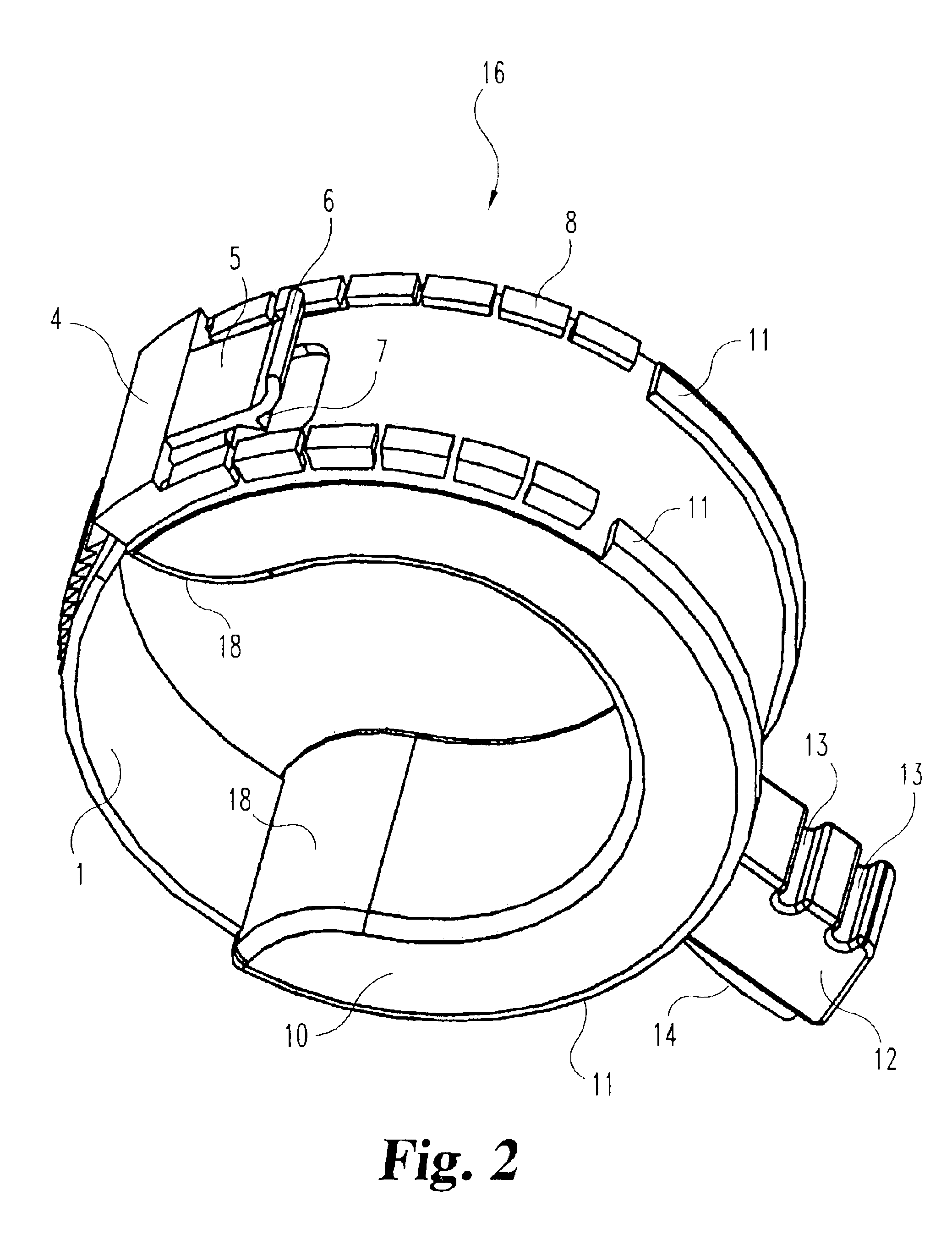 External incontinence device