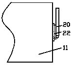 Medical surgical operation anesthetic coating device