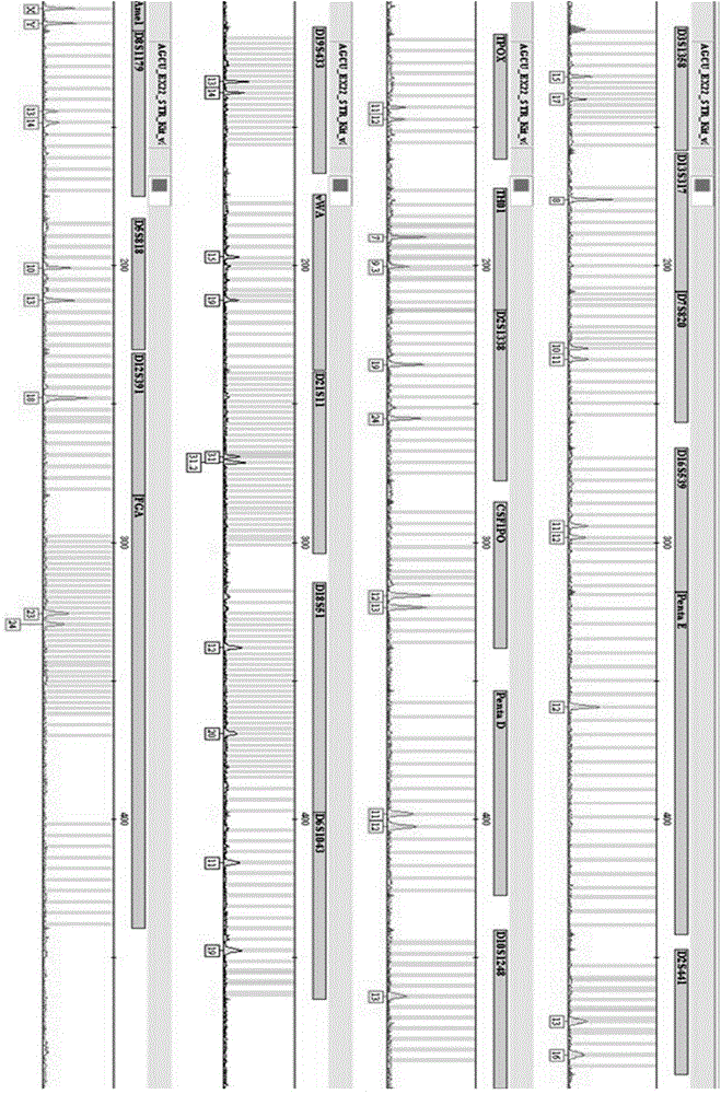 Use of agarose in DNA extraction, DNA extraction kit and DNA extraction method