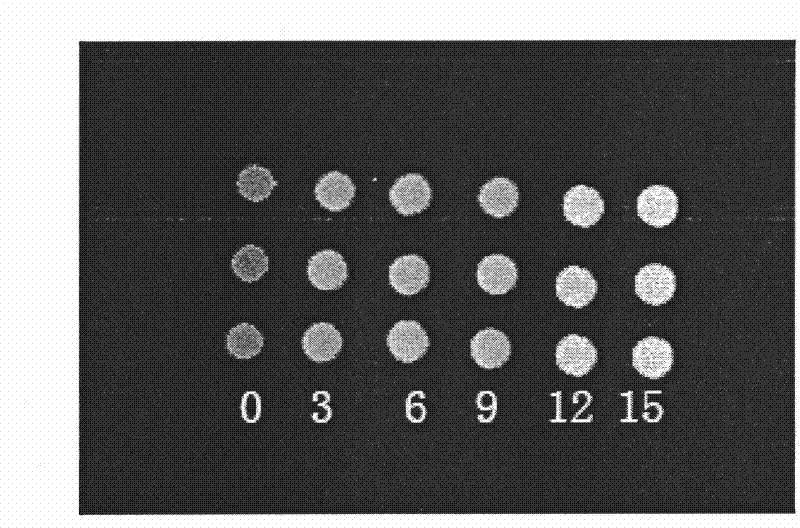 X-ray developing calcium phosphate cement and preparation method and application thereof