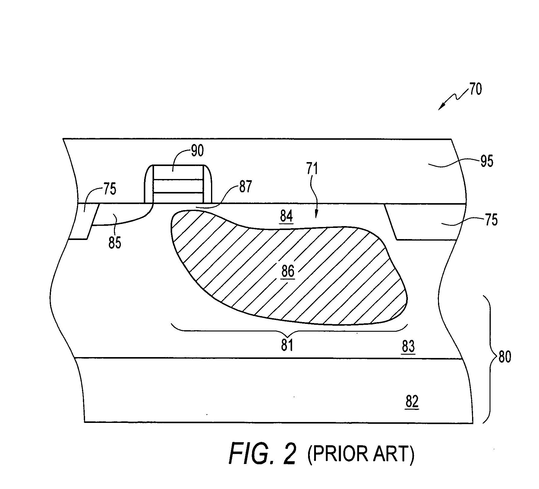 Method and apparatus providing dark current reduction in an active pixel sensor