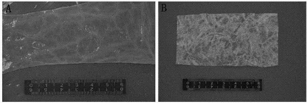 Esophagus repairing material