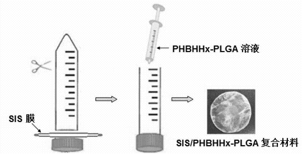 Esophagus repairing material