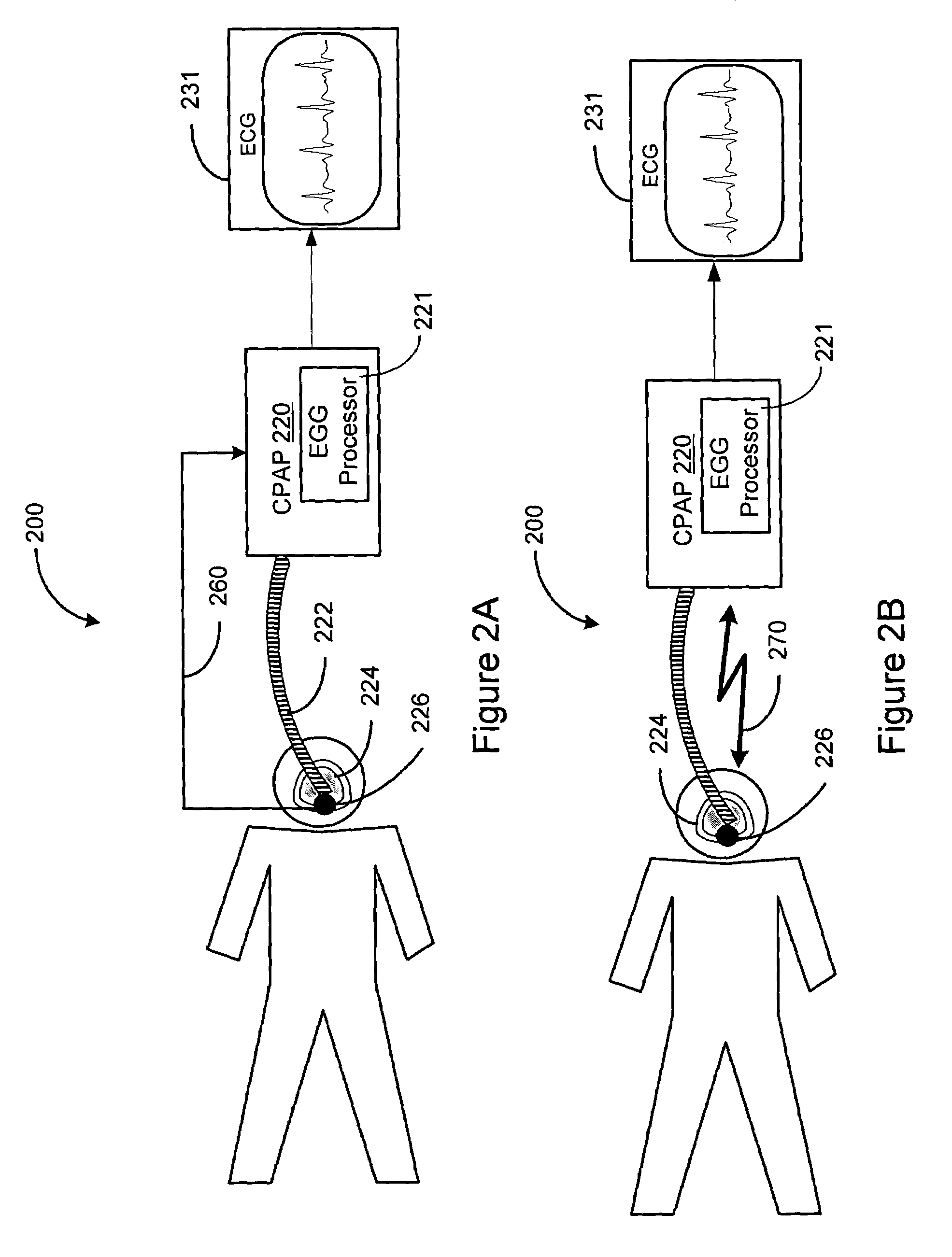 Use of external respiratory therapy device to detect cardiac electrical activity