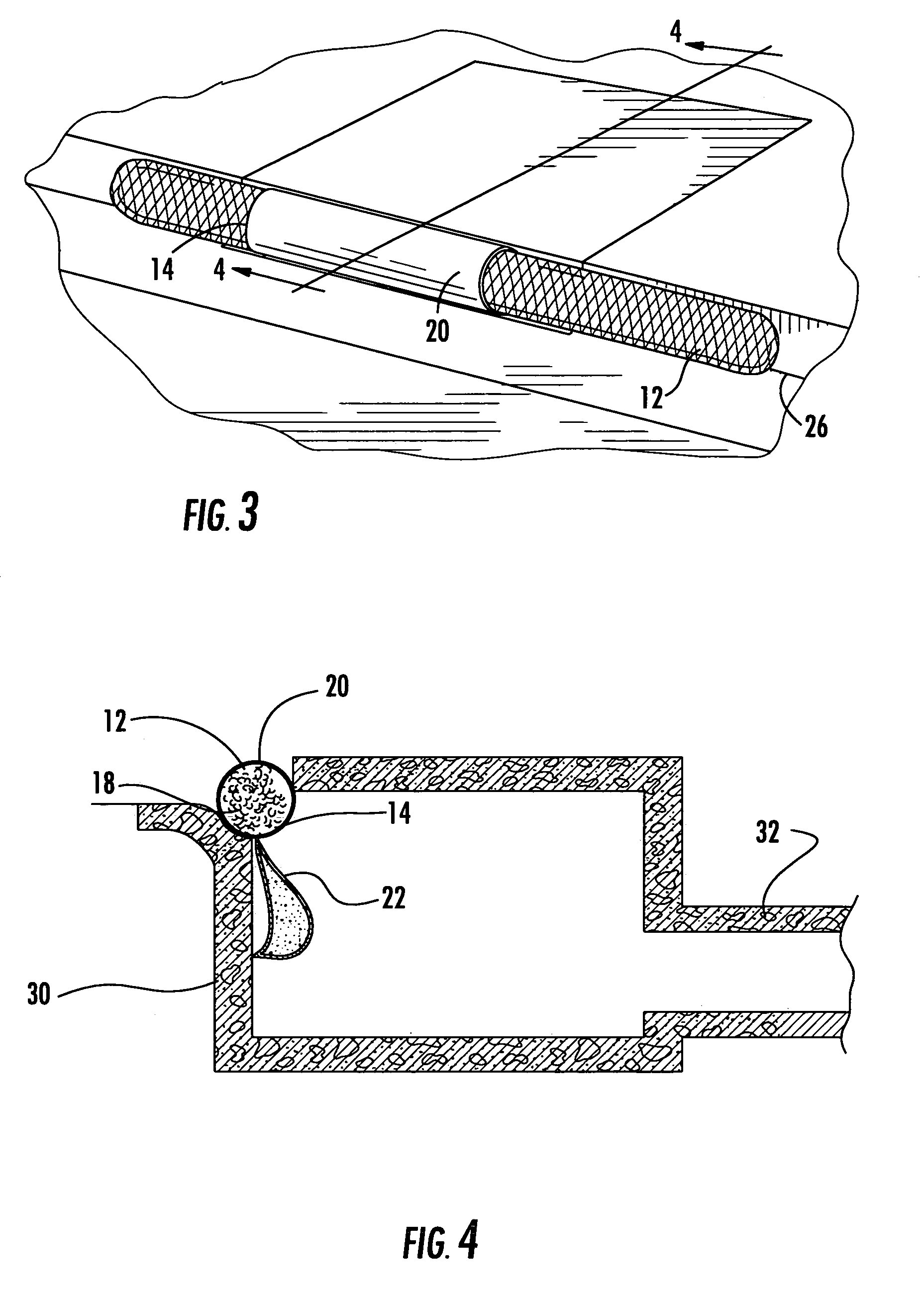 System for filtering stormwater-carried debris flowing through a gutter inlet into a catch basin