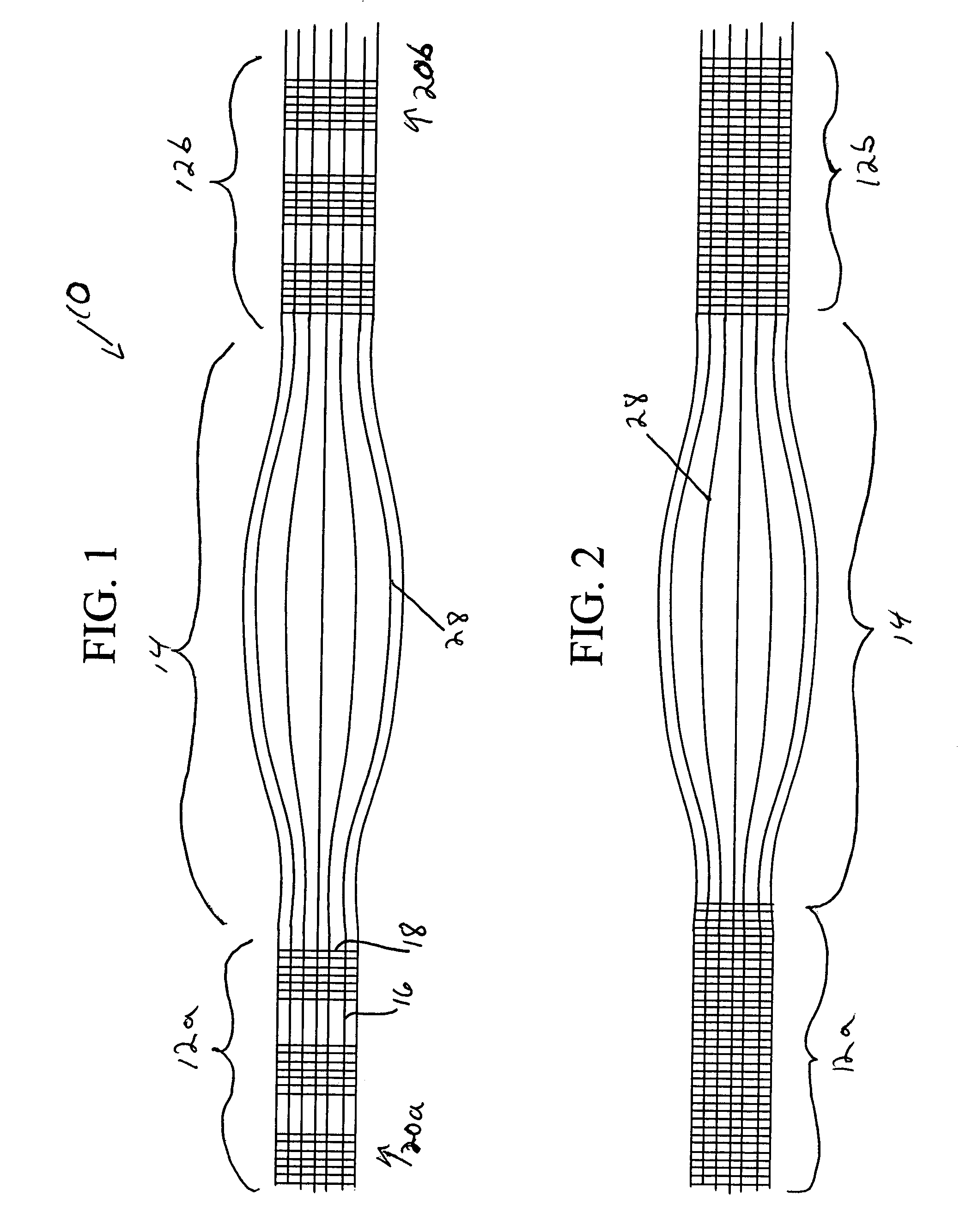 Scaffold for connective tissue repair