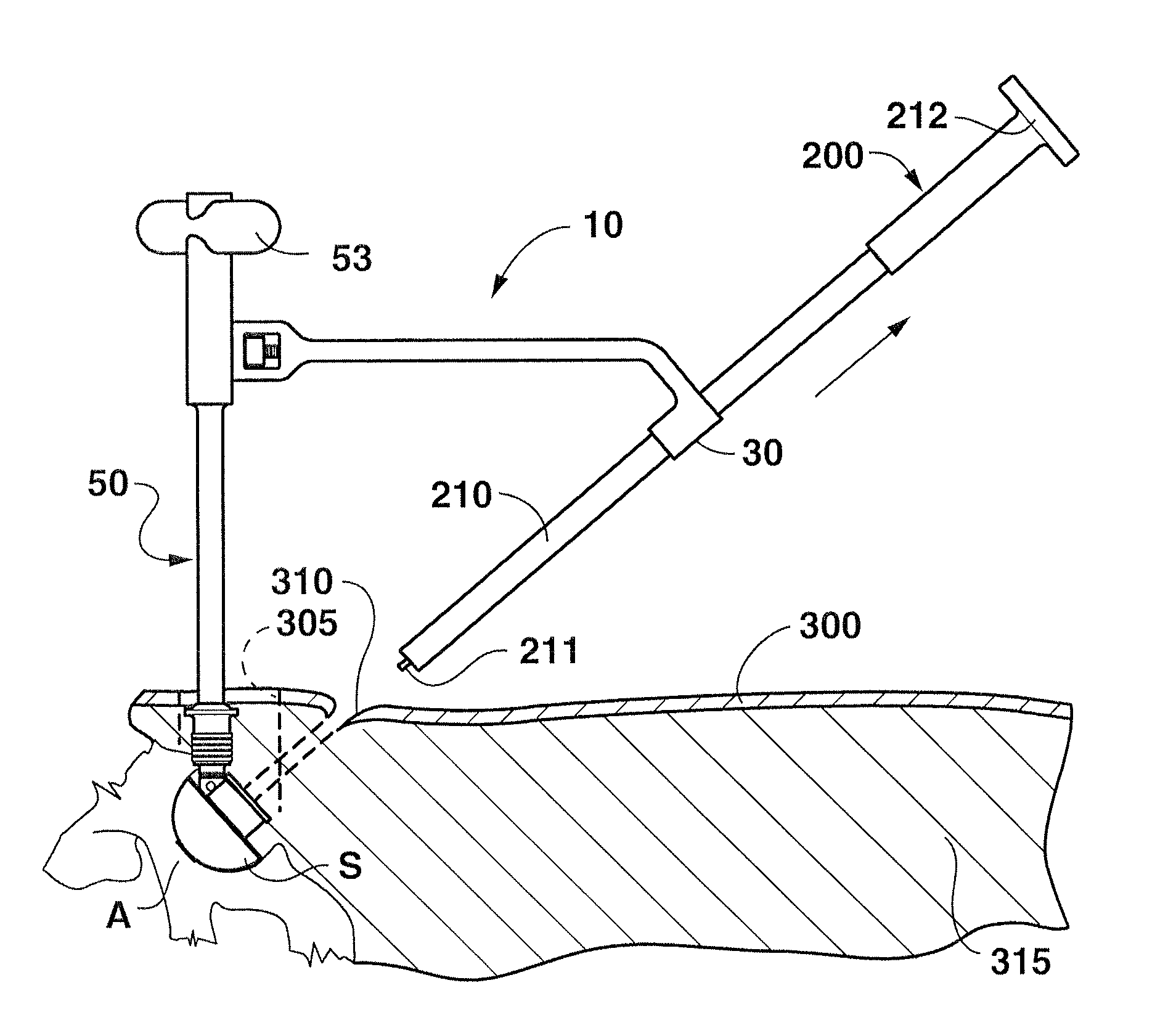 Instrument for Use in Minimally Invasive Surgery