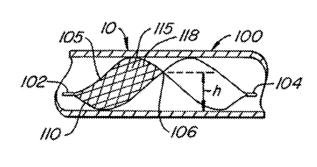 Endoluminal filter with fixation