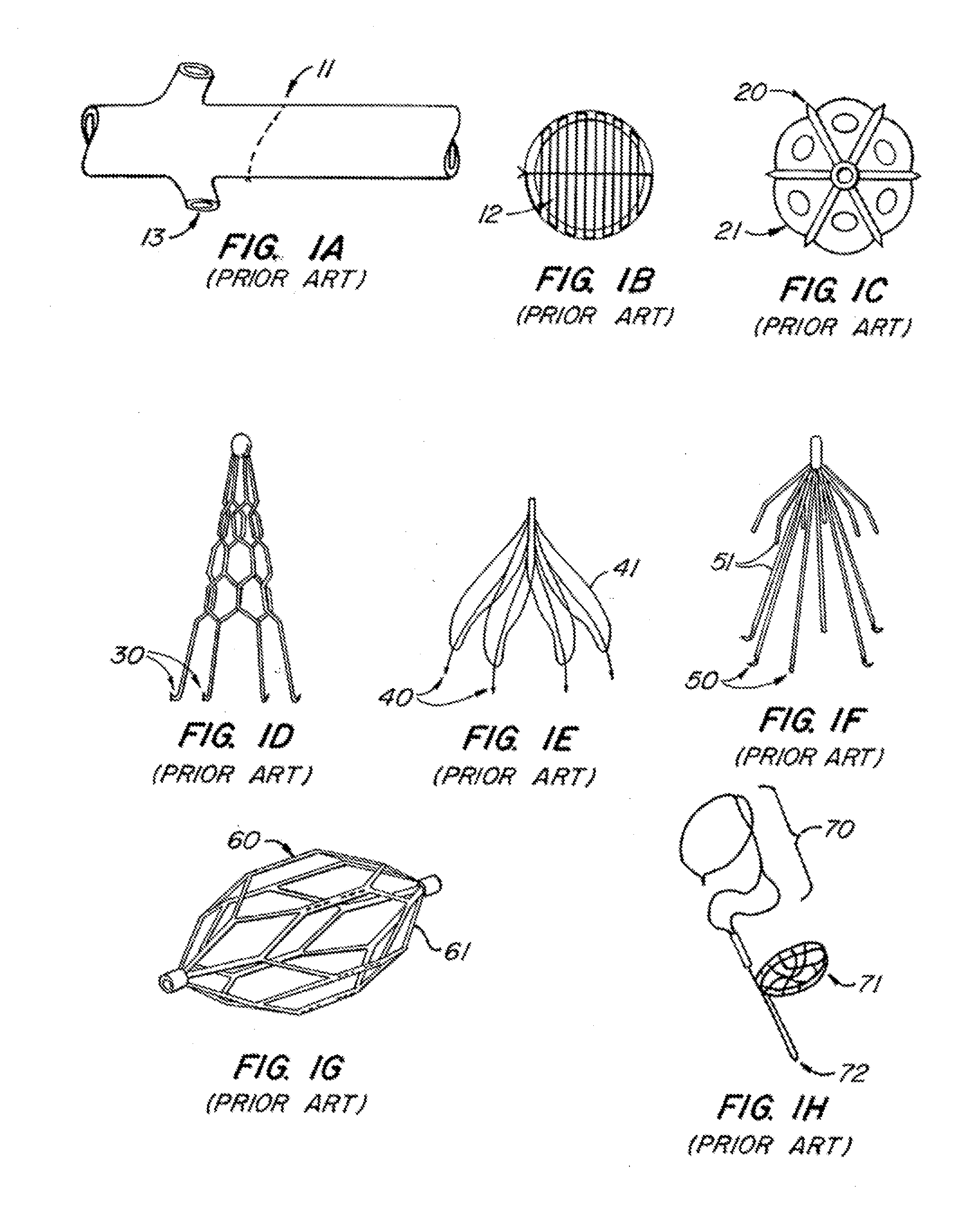 Endoluminal filter with fixation