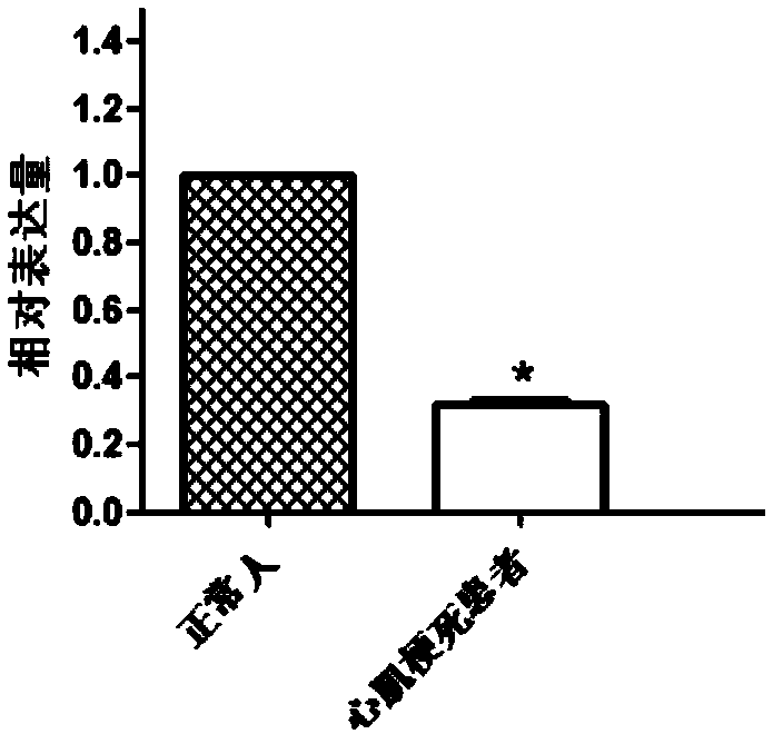 Myocardial infarction diagnosis IVD gene and application thereof