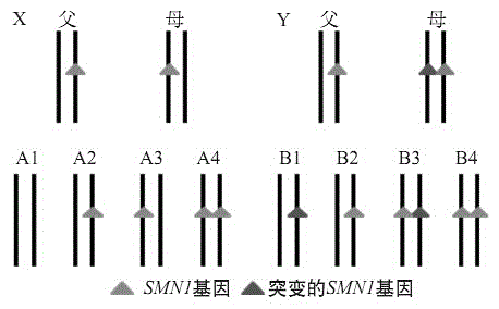 Human embryo spinal muscular atrophy mutant gene detection kit