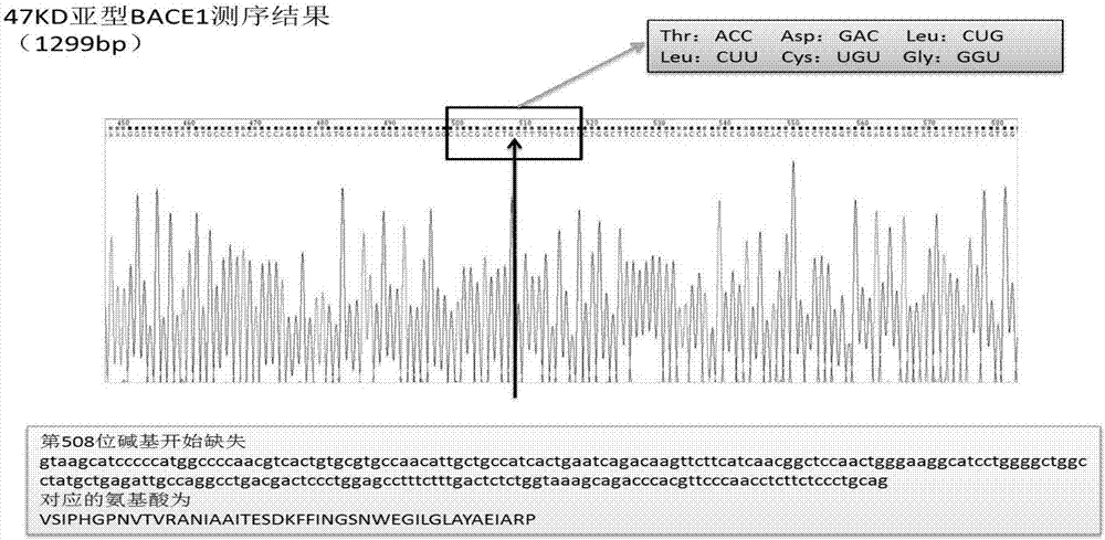 Functional research and development of BACE1 subtype for inhibiting accumulation of Abeta in brain and application of BACE1 subtype