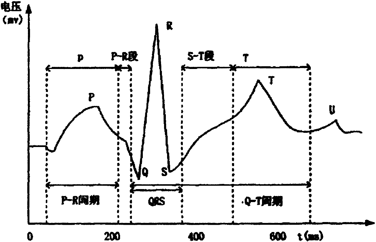 Adaptive collection empirical mode decomposition based electrocardiosignal characteristic point identification method