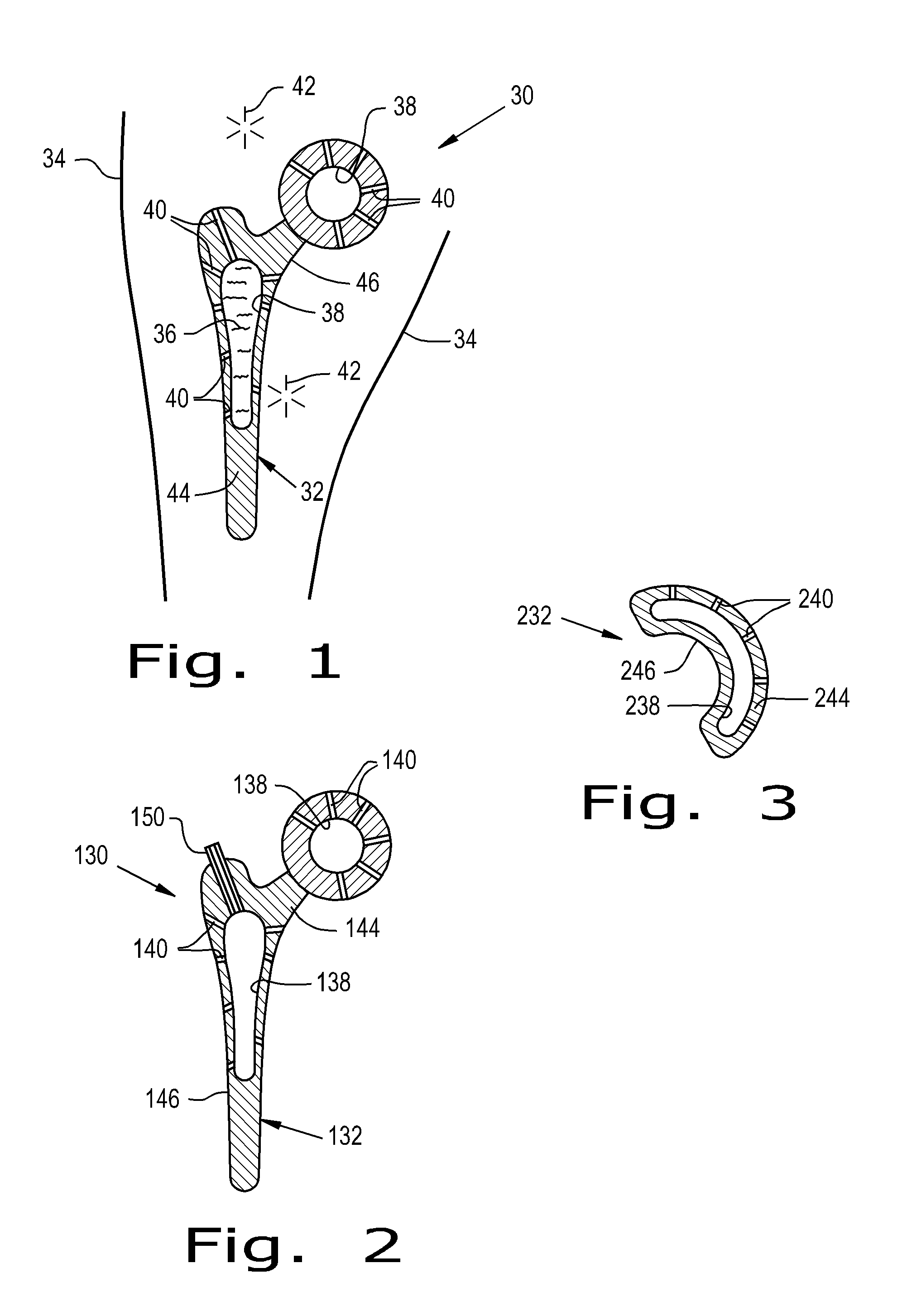 Drug delivery implants