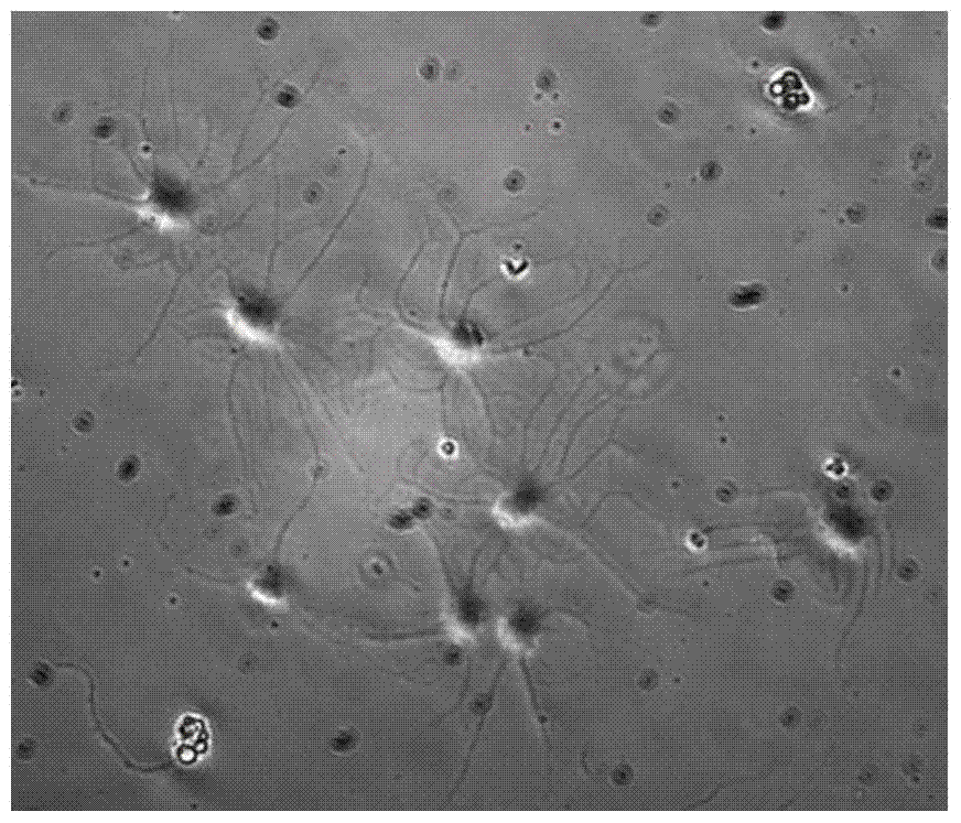 A kind of in vitro isolation and culture method and application of mammalian trigeminal ganglion cells