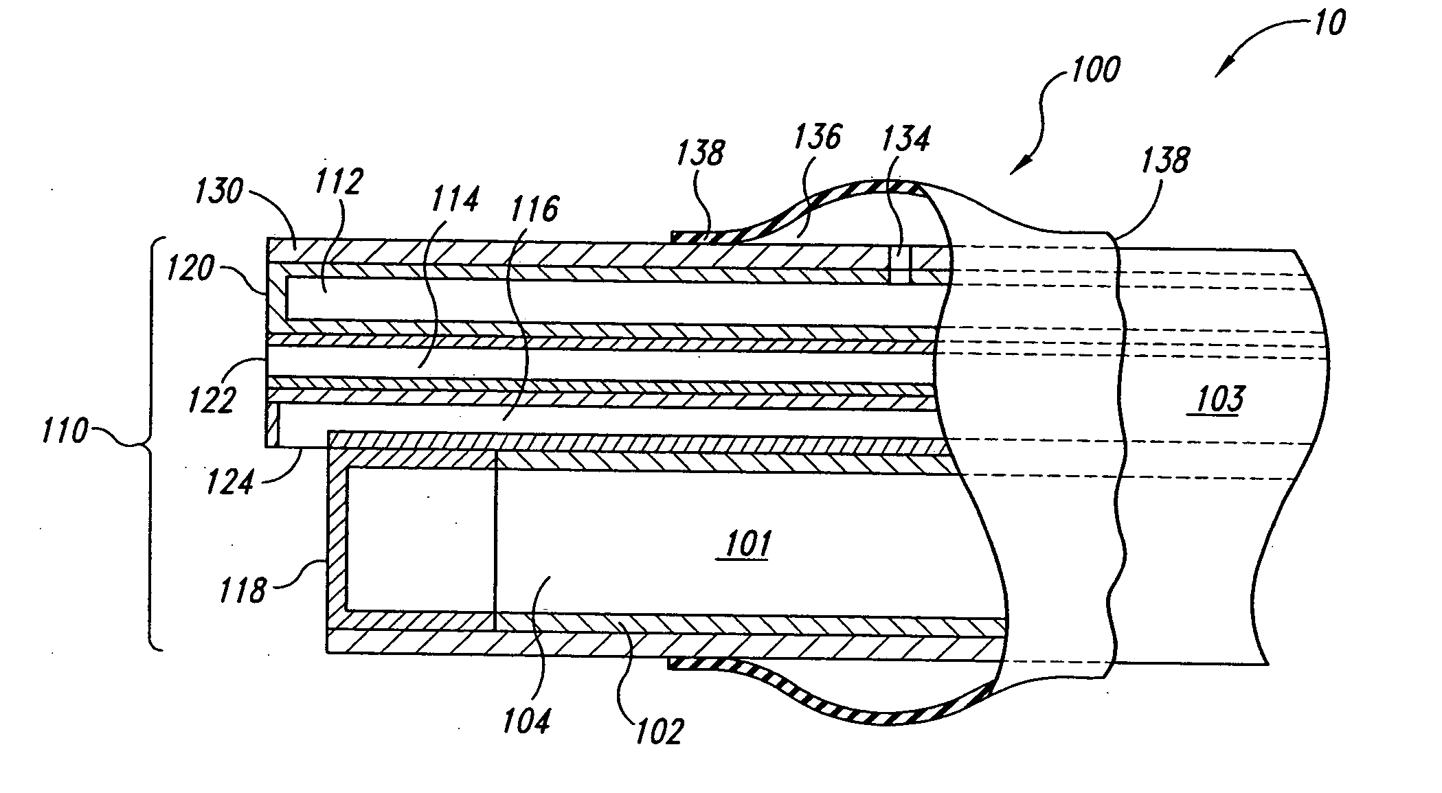 Inflatable member for an endoscope sheath