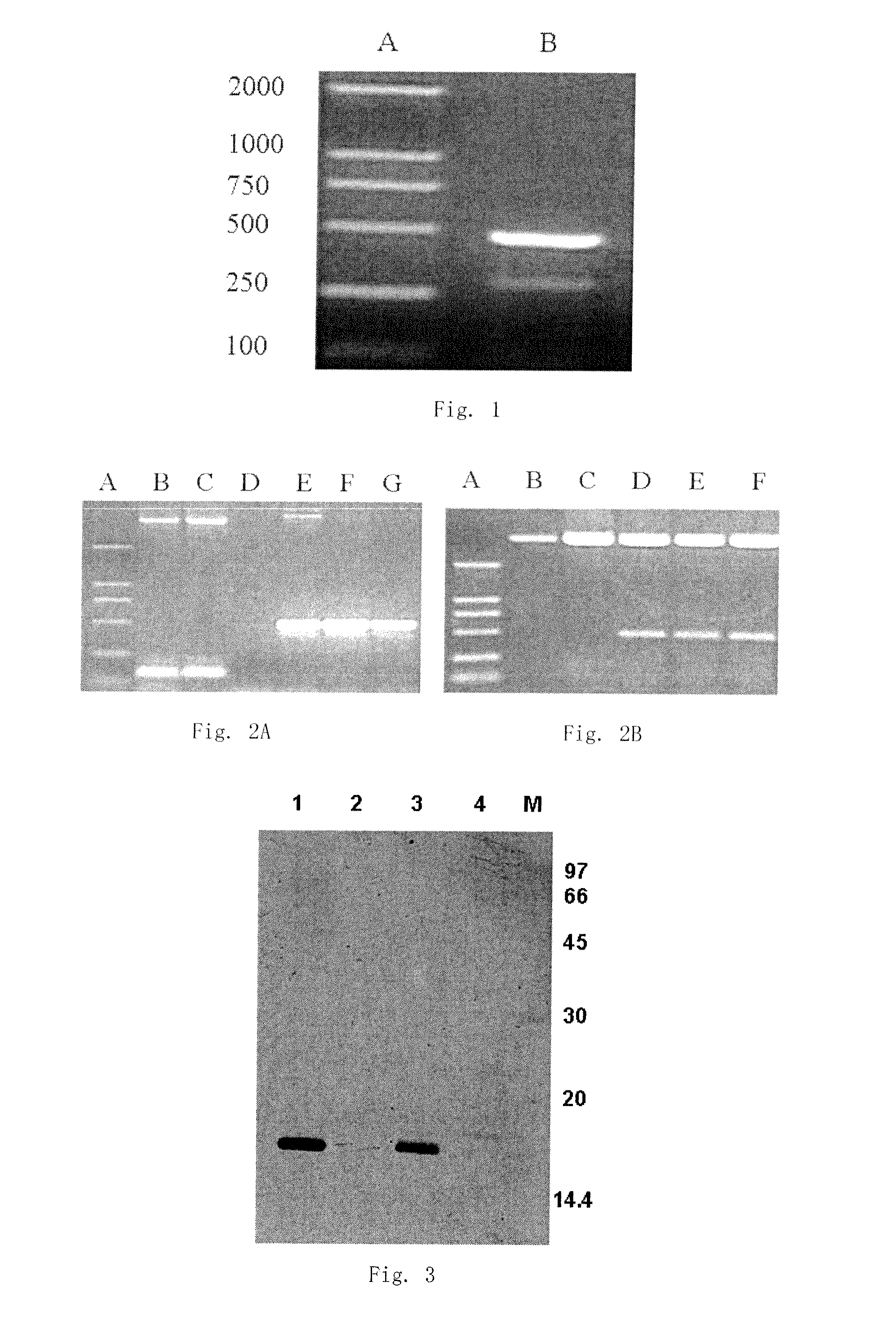 A neuroglobin enzyme-linked immunosorbent assay kit and the use of it