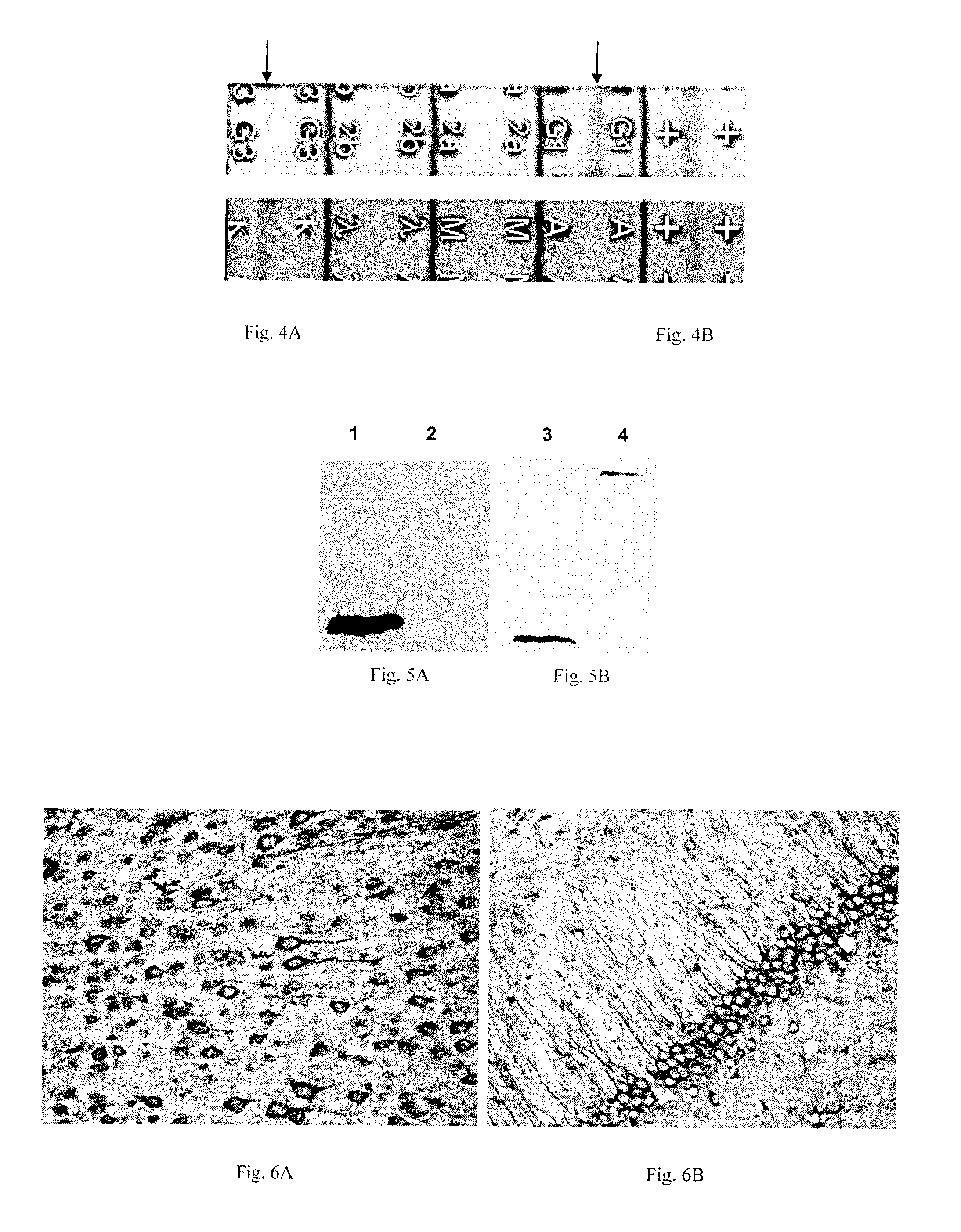 A neuroglobin enzyme-linked immunosorbent assay kit and the use of it