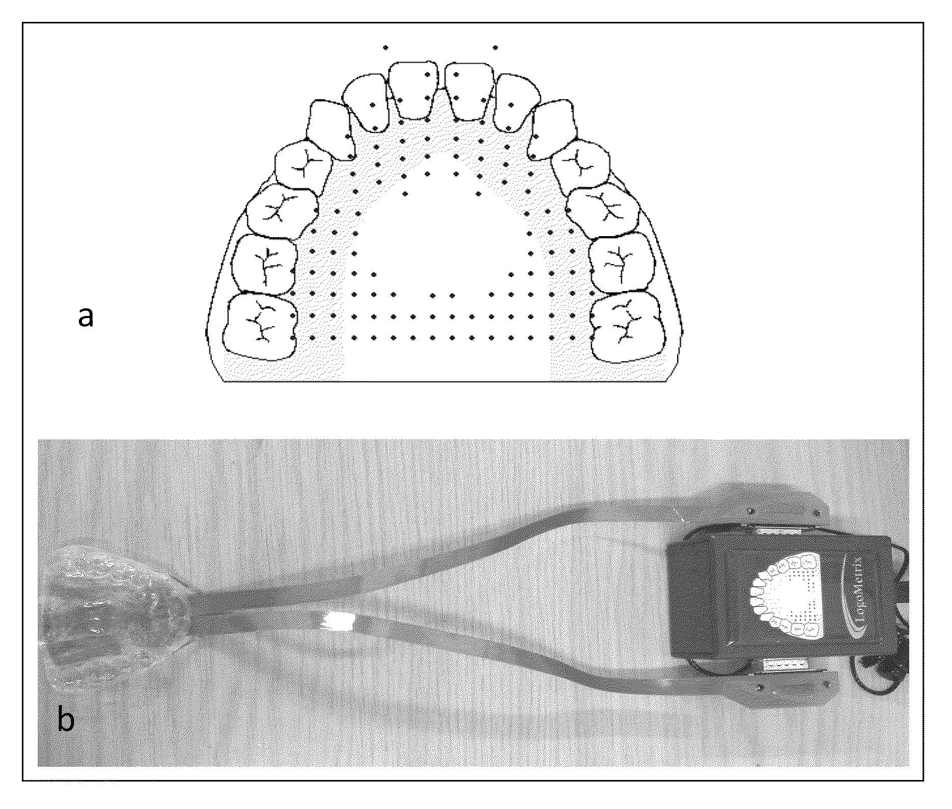 Artificial larynx