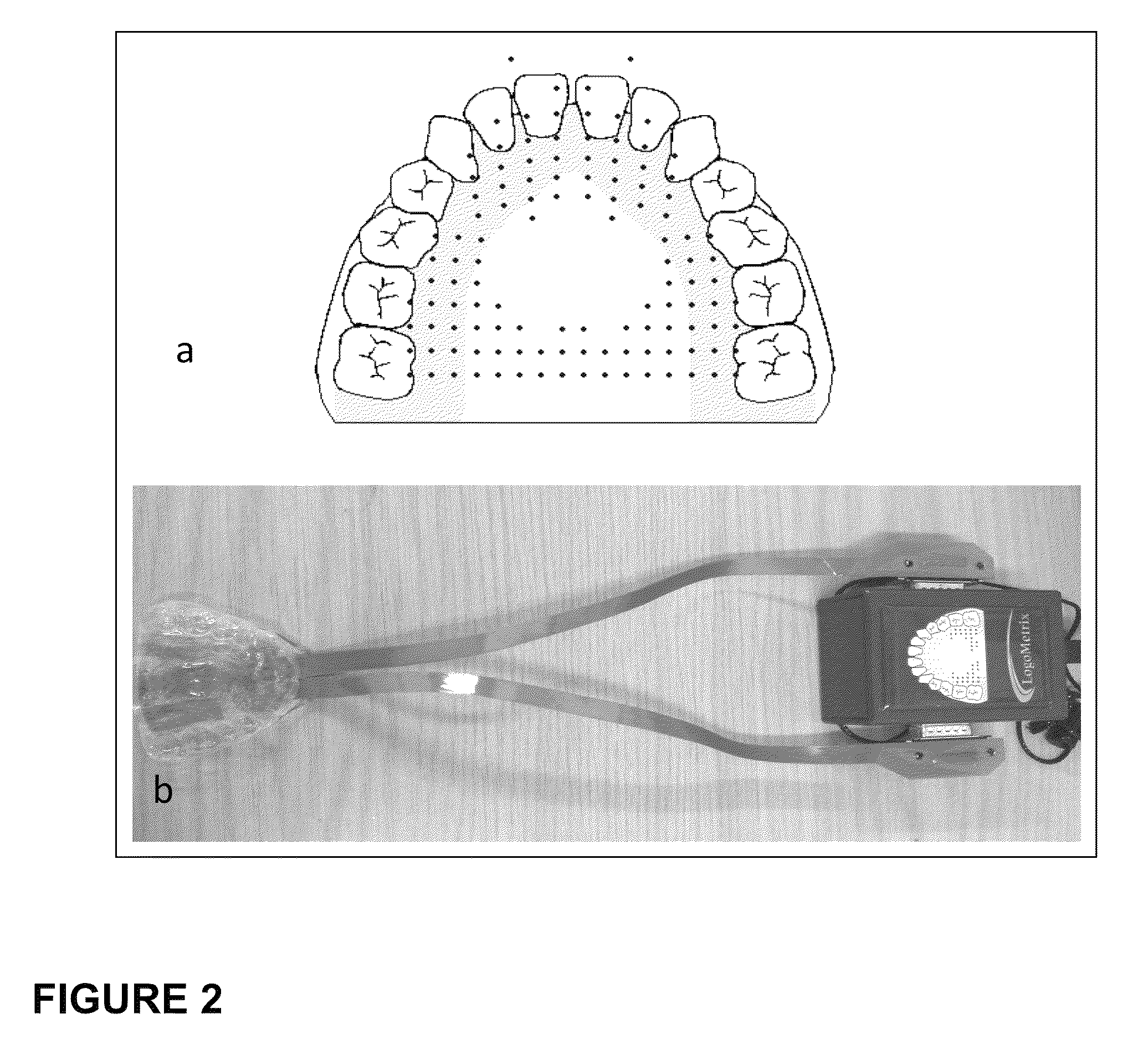 Artificial larynx