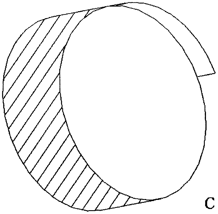 Adjustable fistula channel curettage device