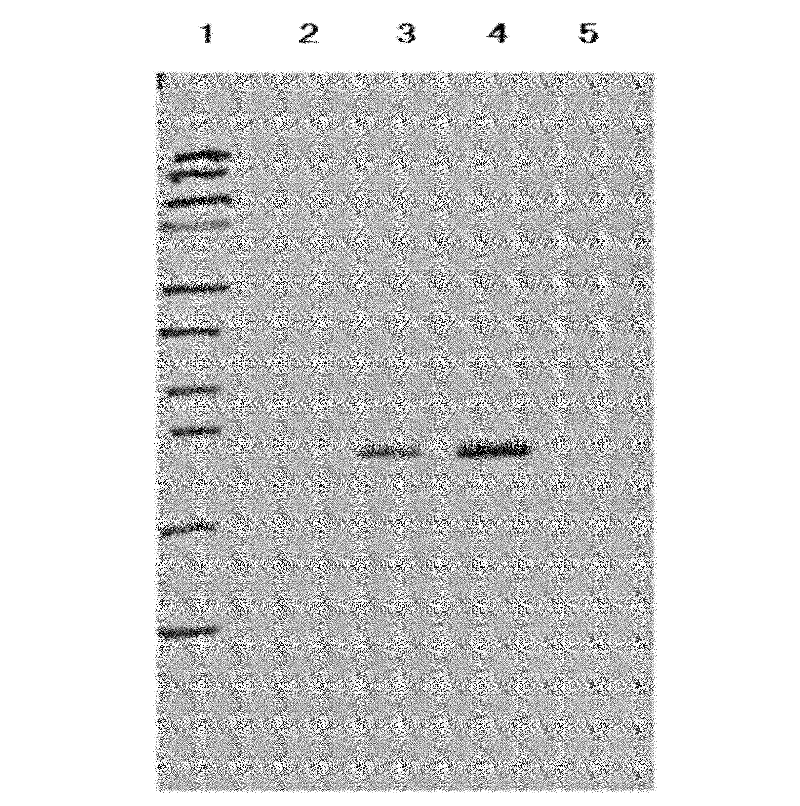 Whole blood INF-gamma specific antigen protein and preparation method and application thereof